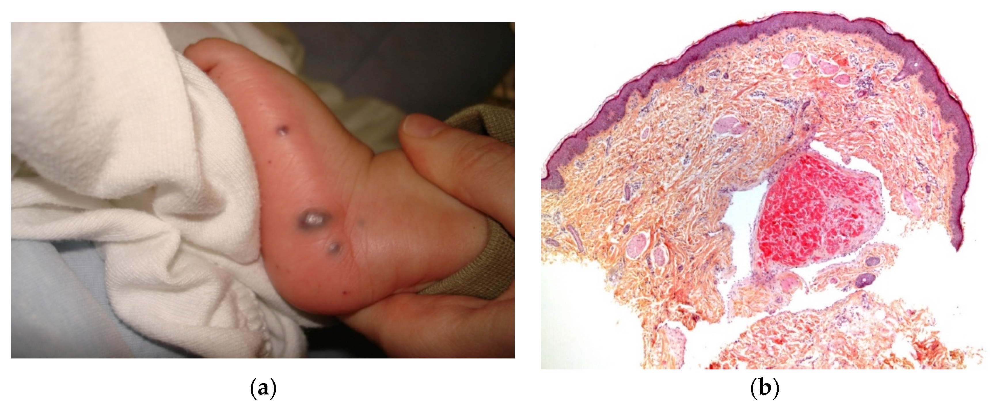 Dermatopathology 08 00043 g017