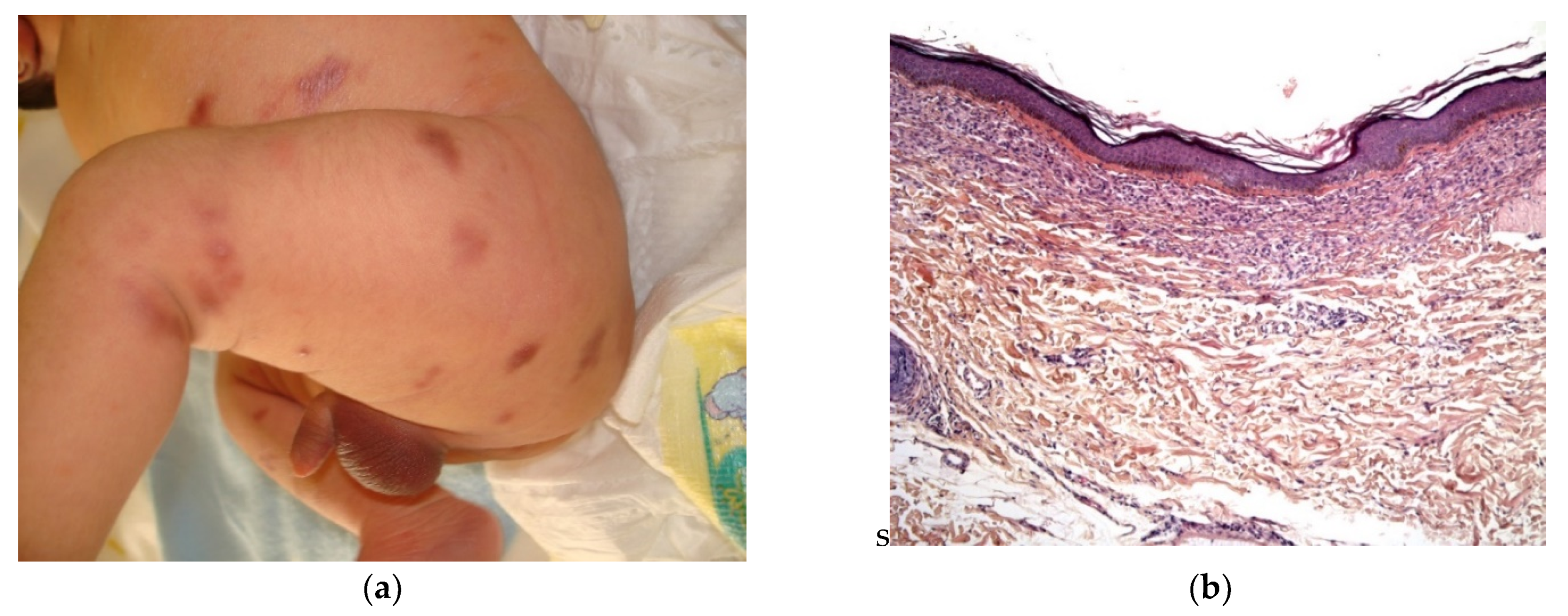 Dermatopathology 08 00043 g018a