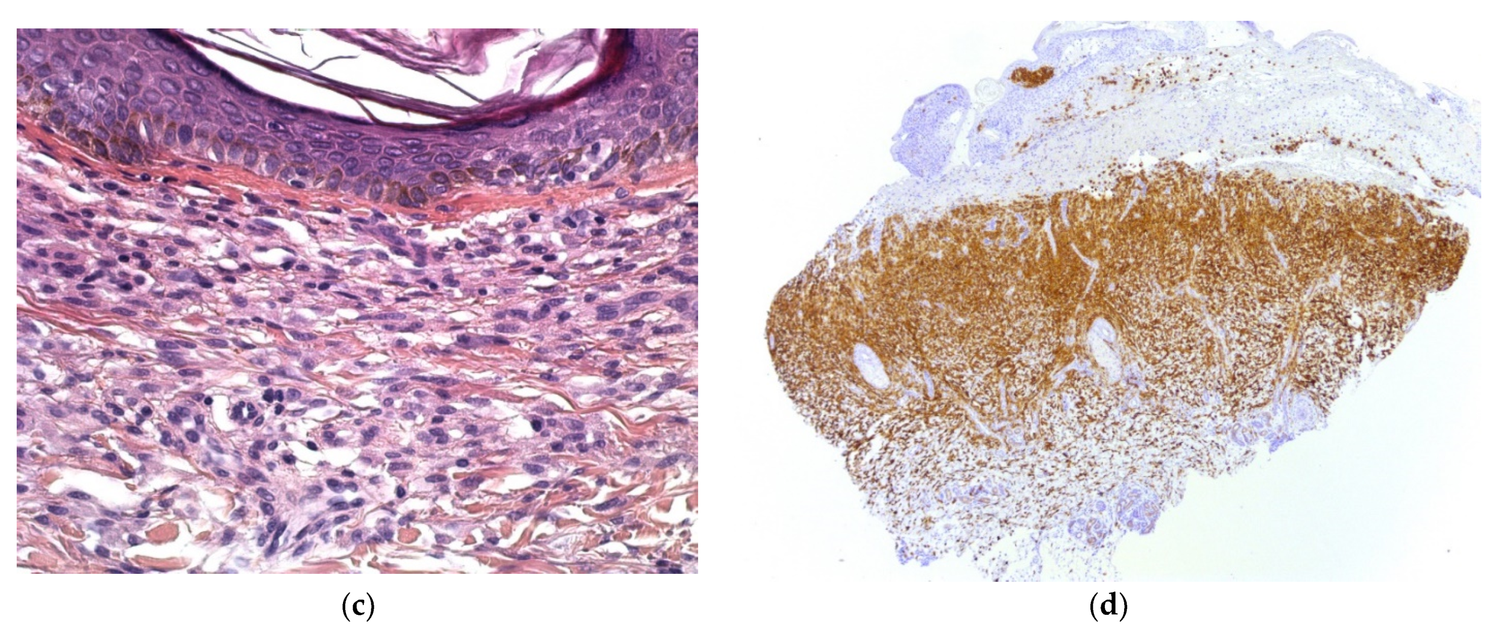 Dermatopathology 08 00043 g018b