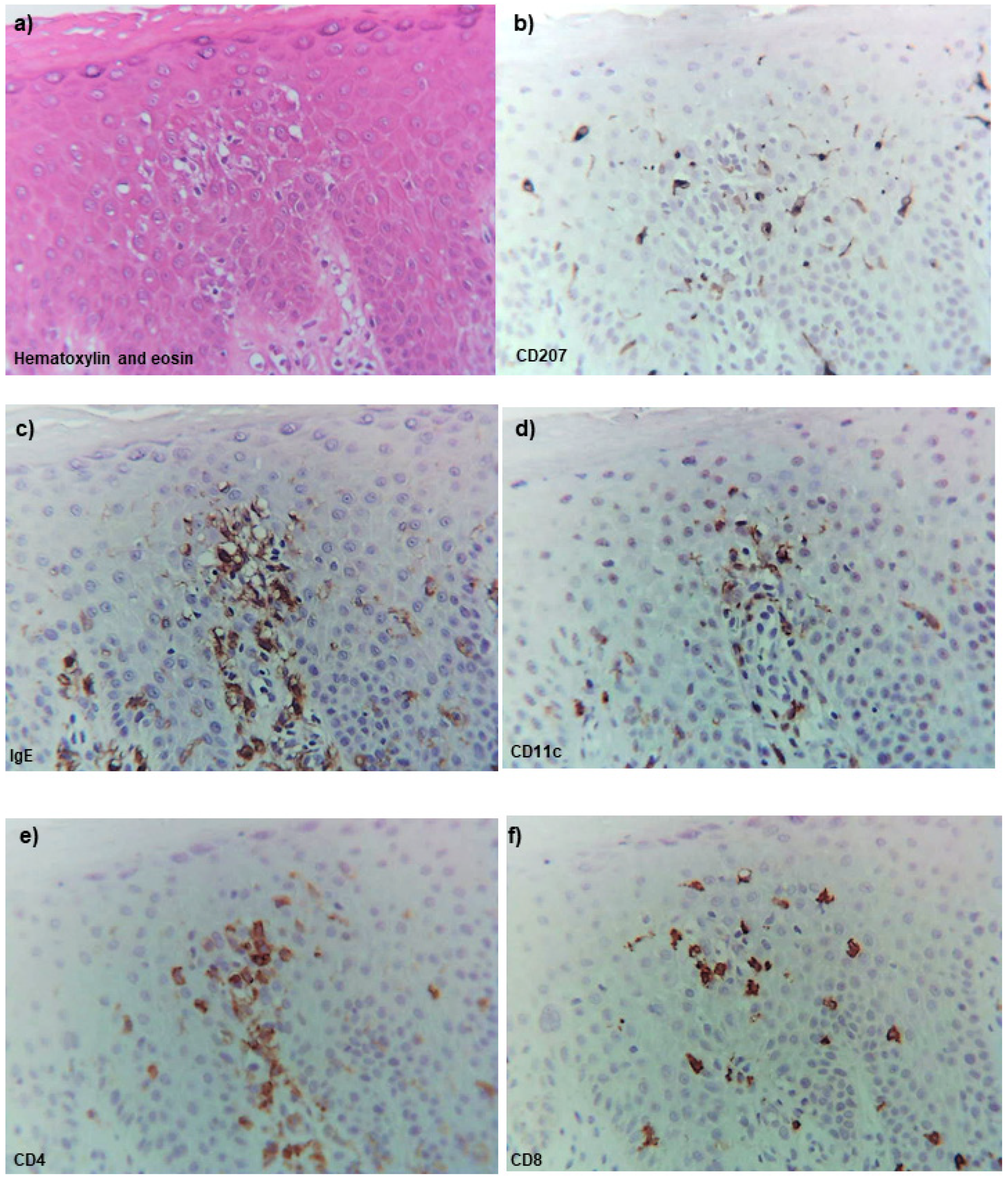 Dermatopathology 08 00045 g004