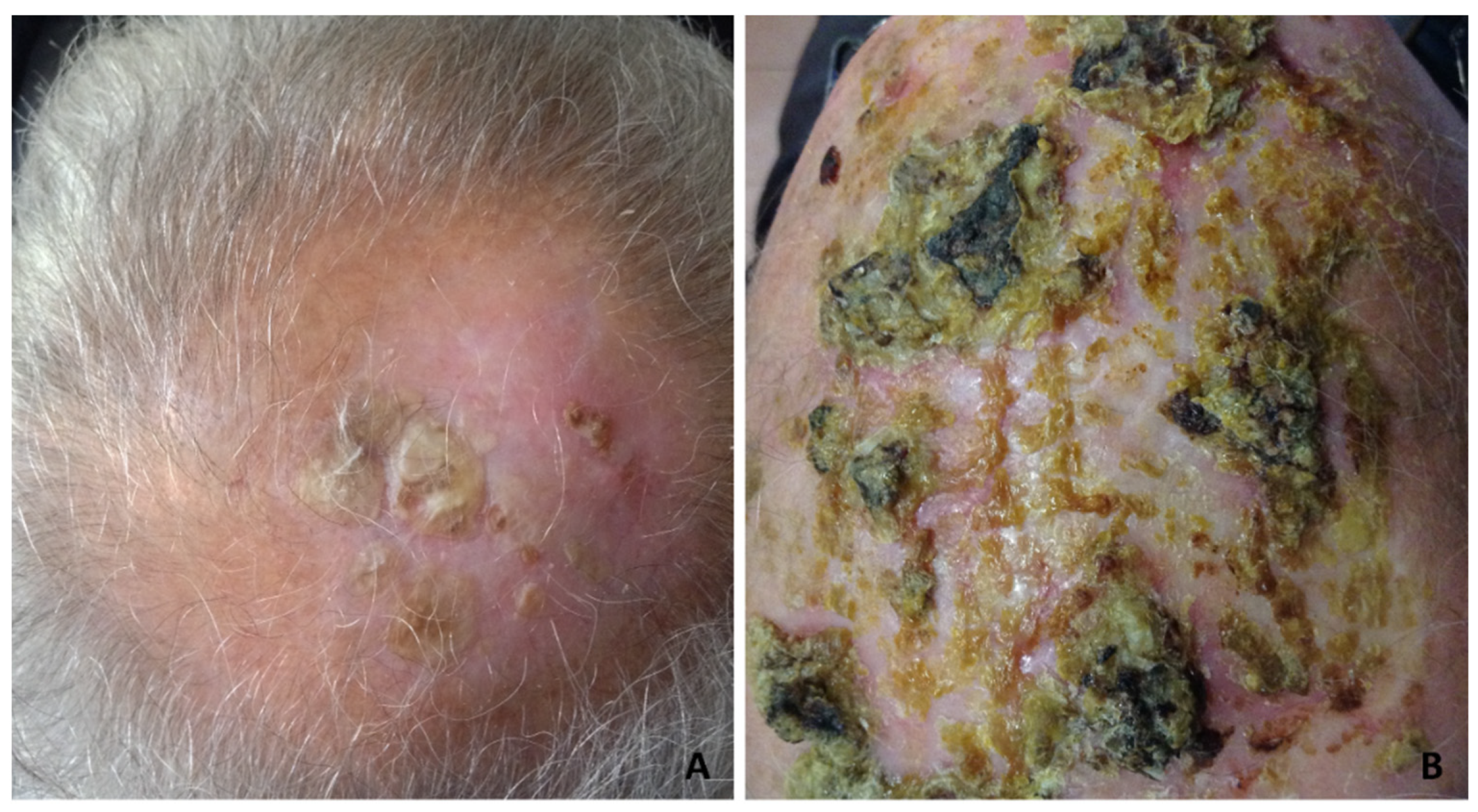 Dermatopathology 08 00048 g002