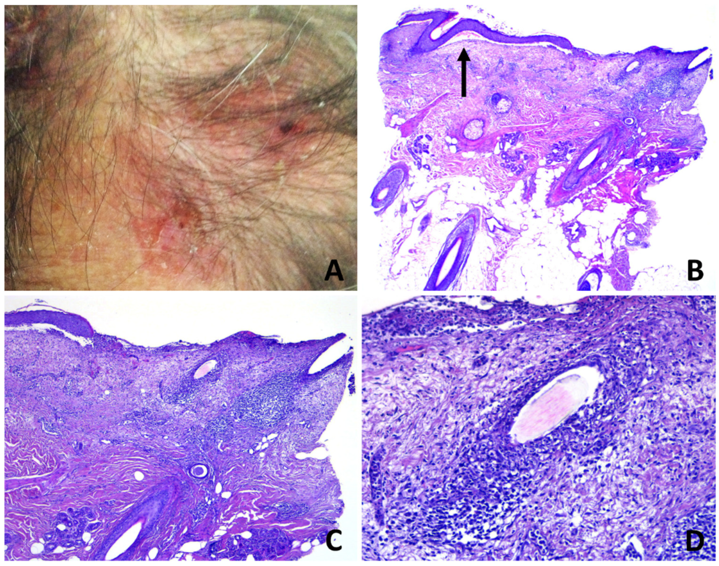 Dermatopathology 08 00048 g003