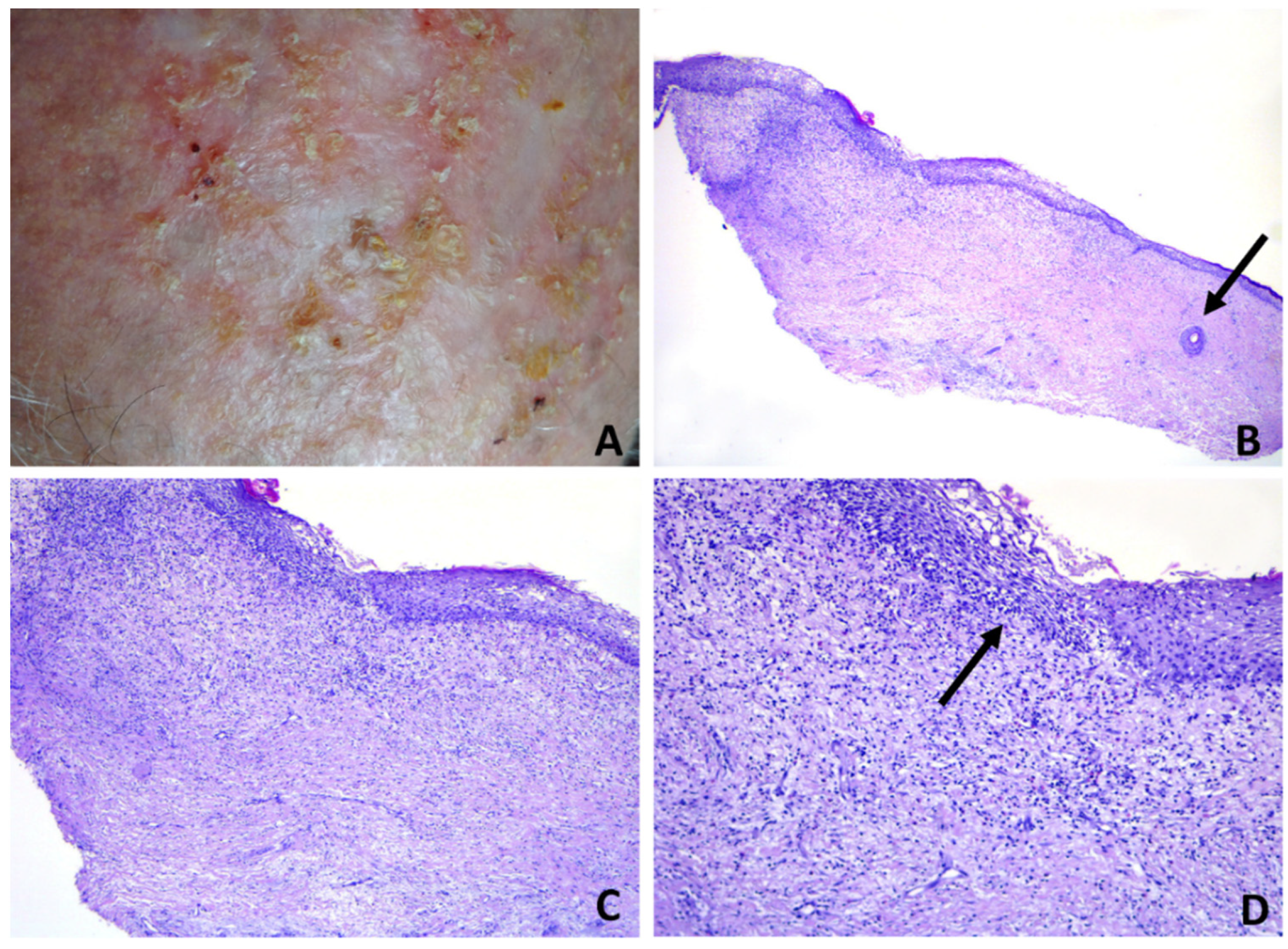 Dermatopathology 08 00048 g006