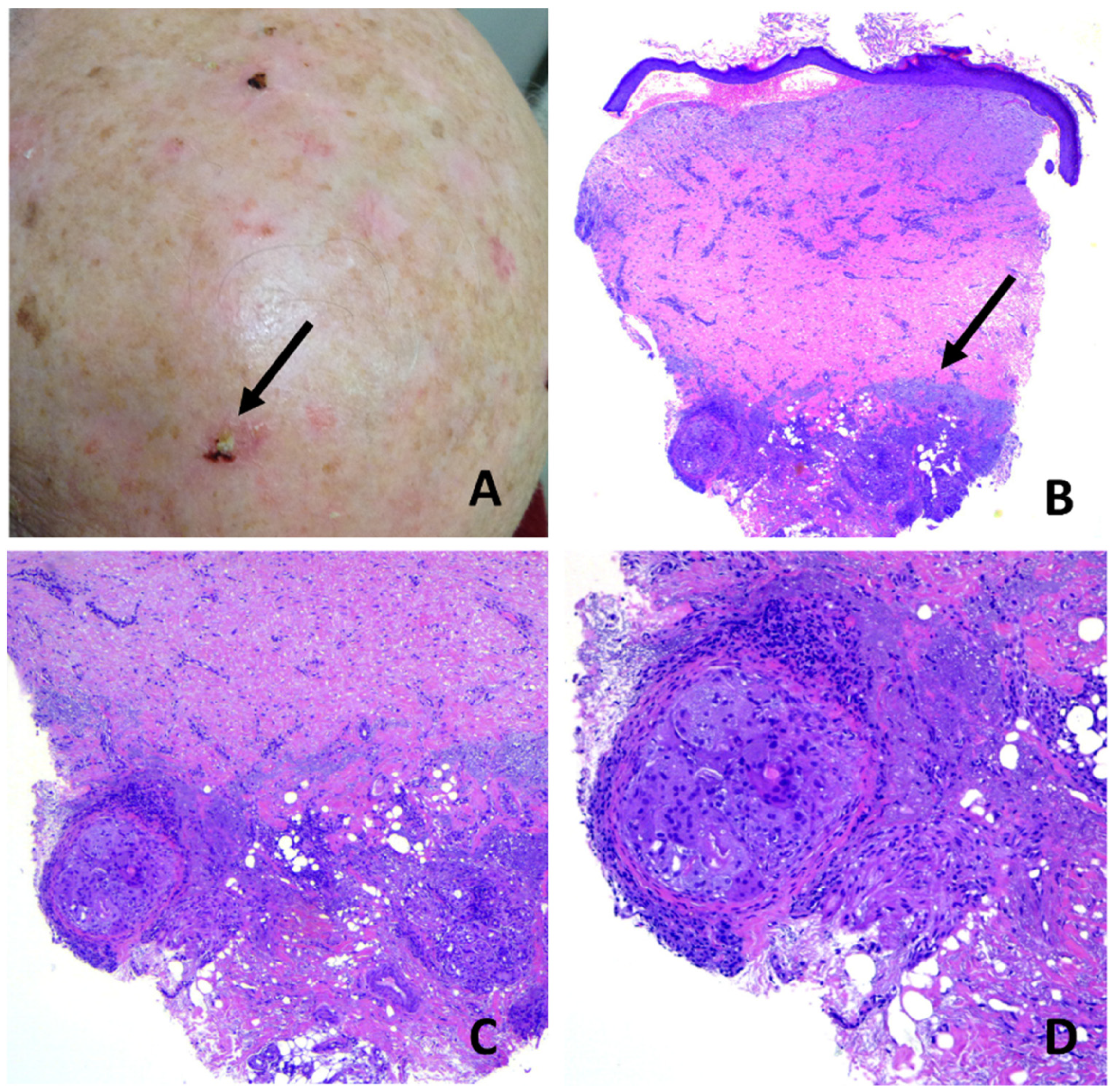 Dermatopathology 08 00048 g007
