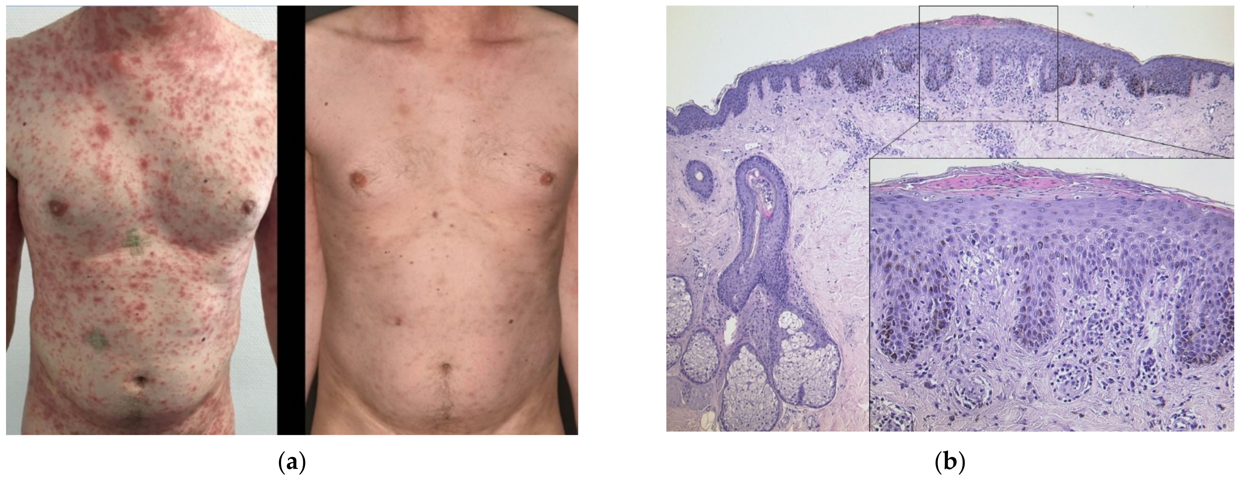 Dermatopathology 08 00049 g003