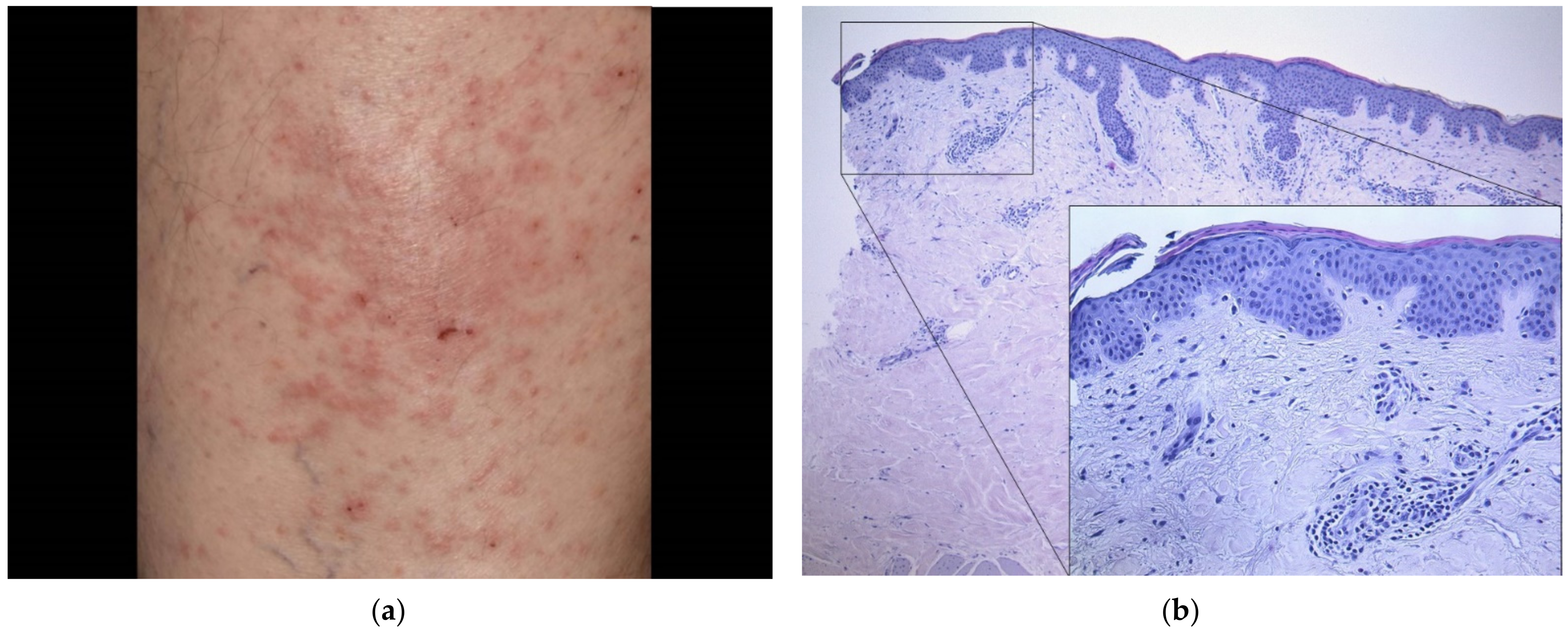 Dermatopathology 08 00049 g004