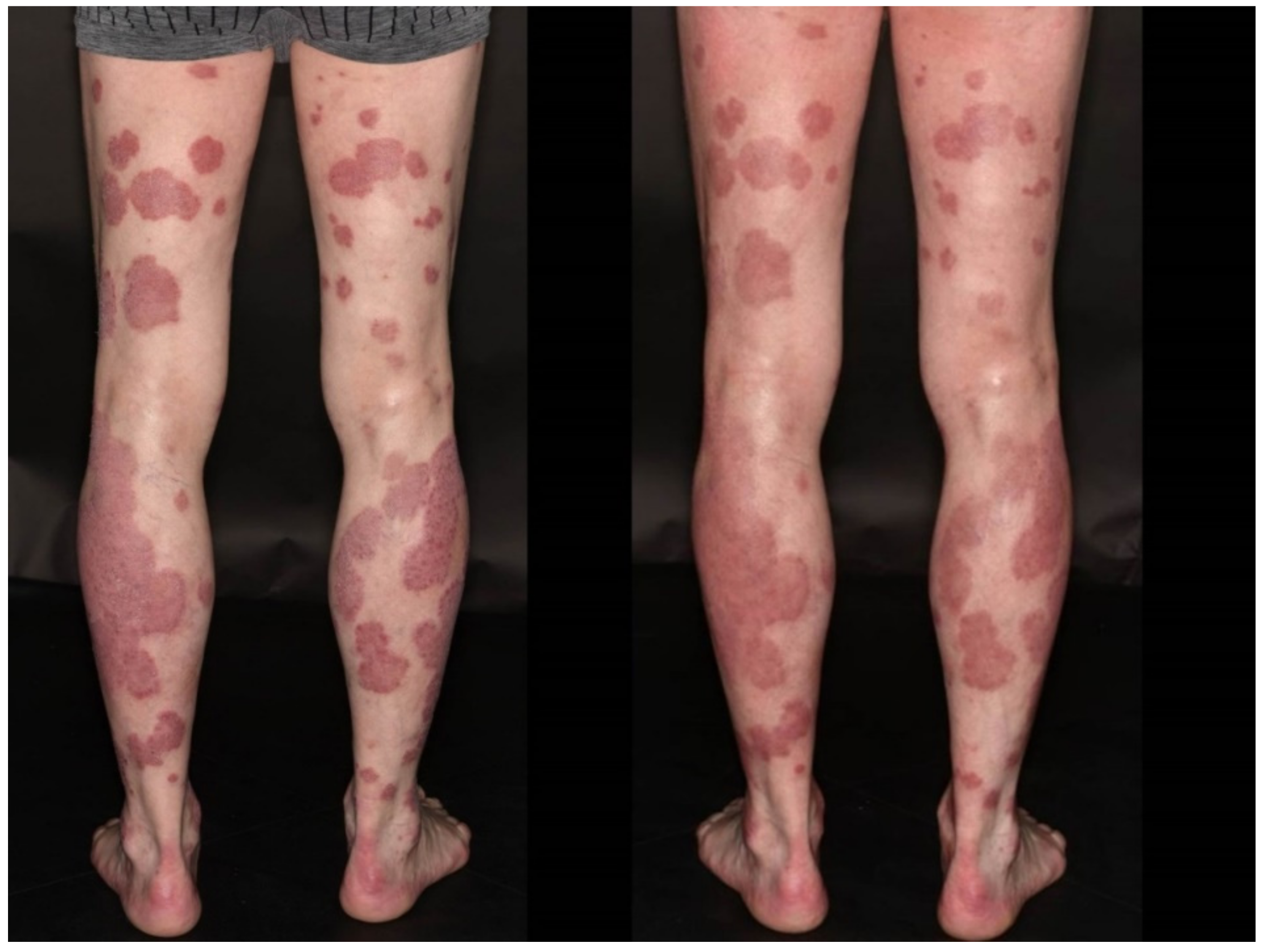 Dermatopathology 08 00049 g005