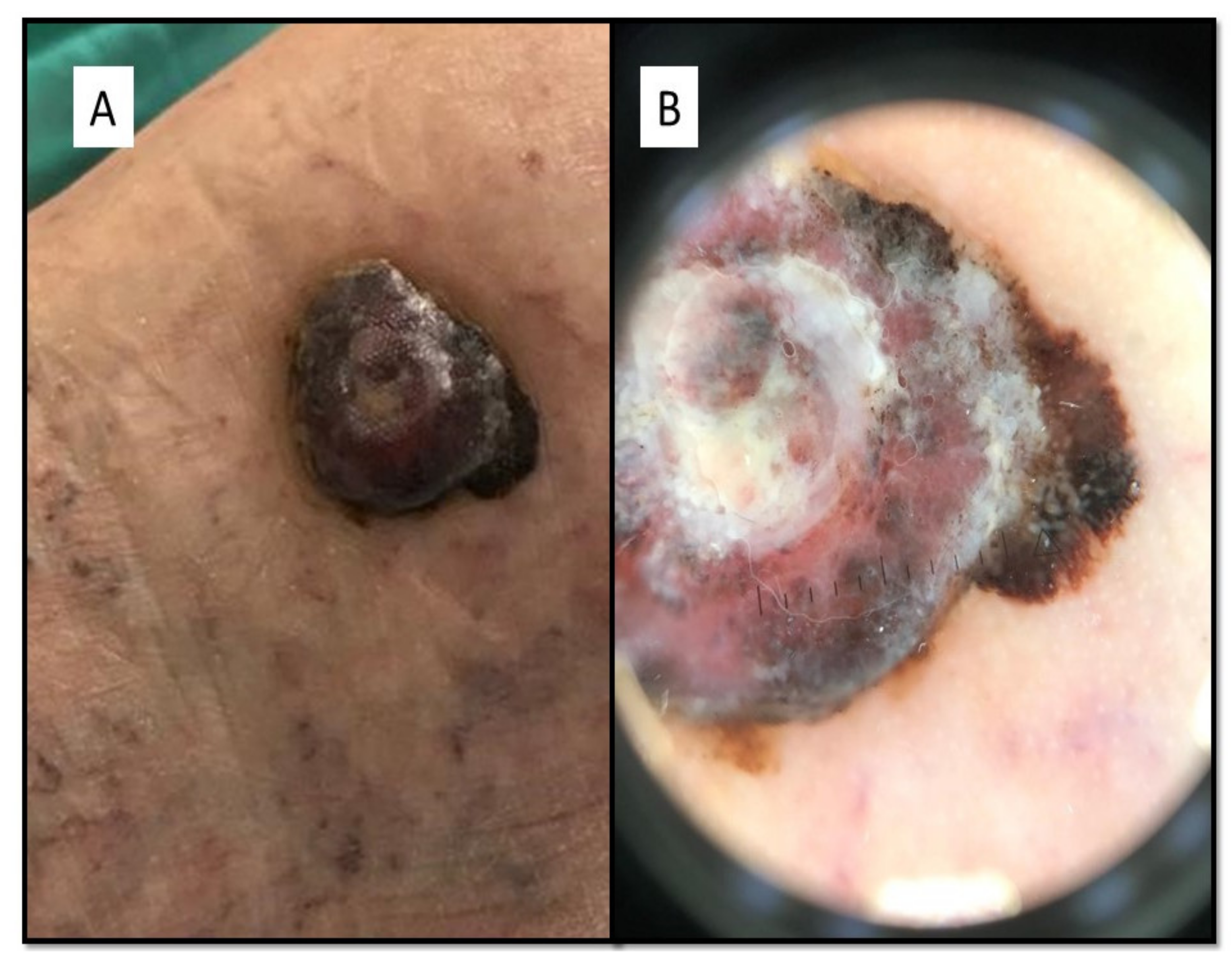 Dermatopathology 08 00051 g001