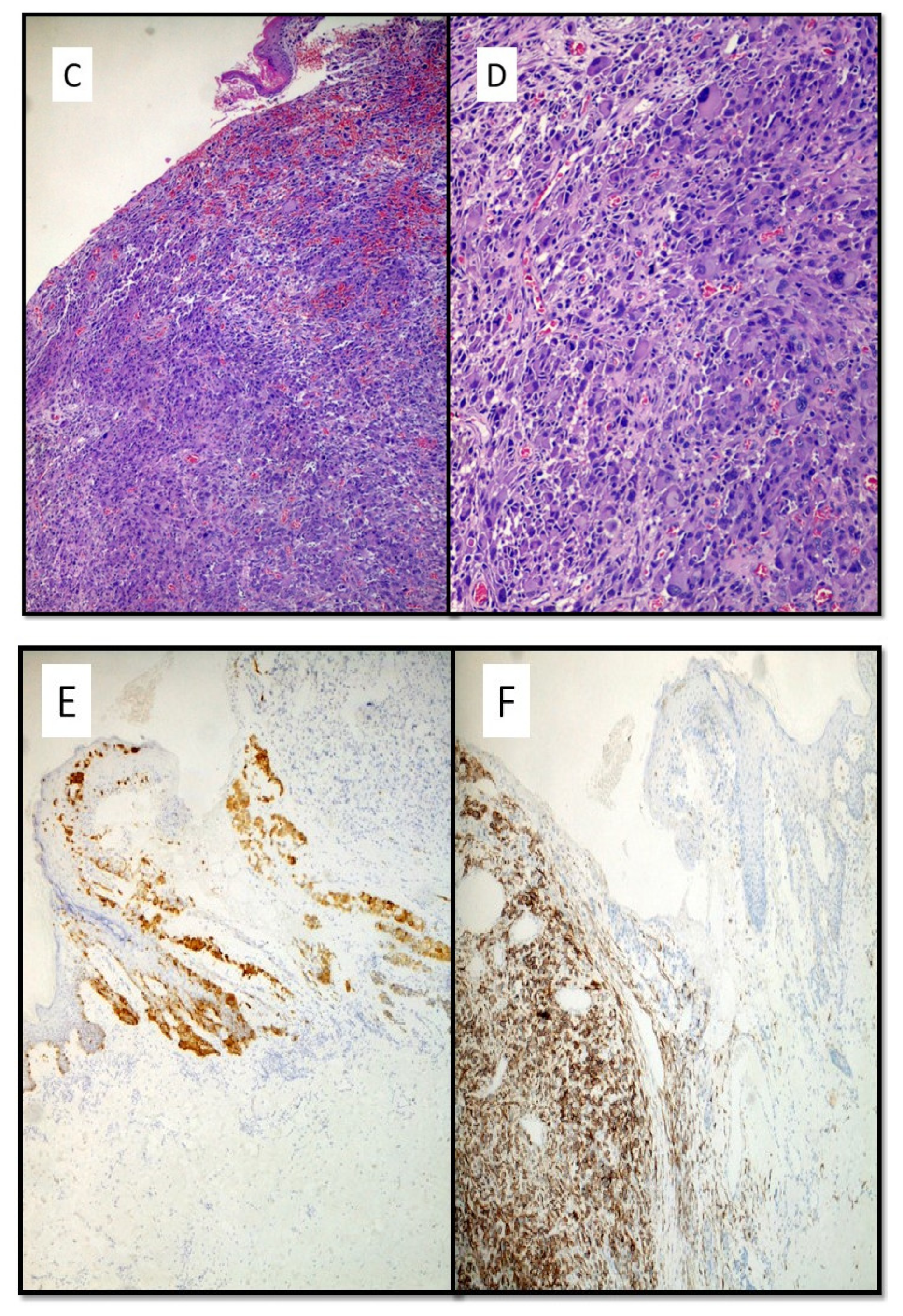 Dermatopathology 08 00051 g002b