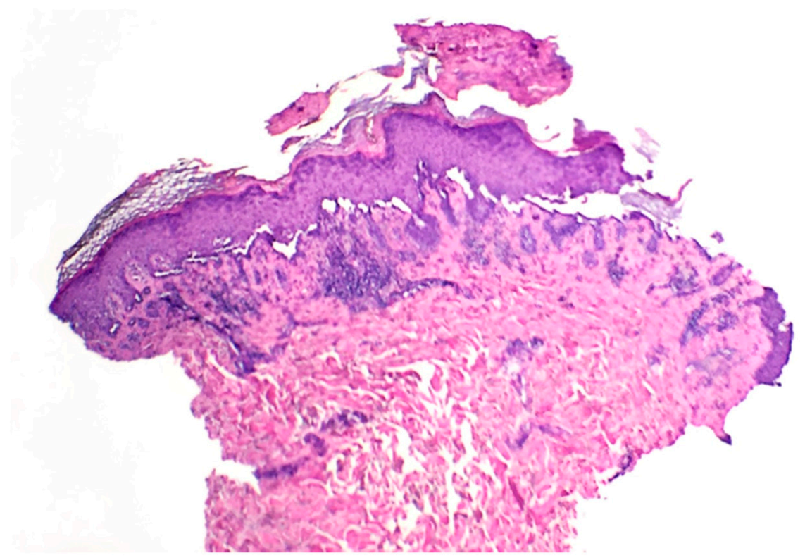 Dermatopathology 08 00052 g002