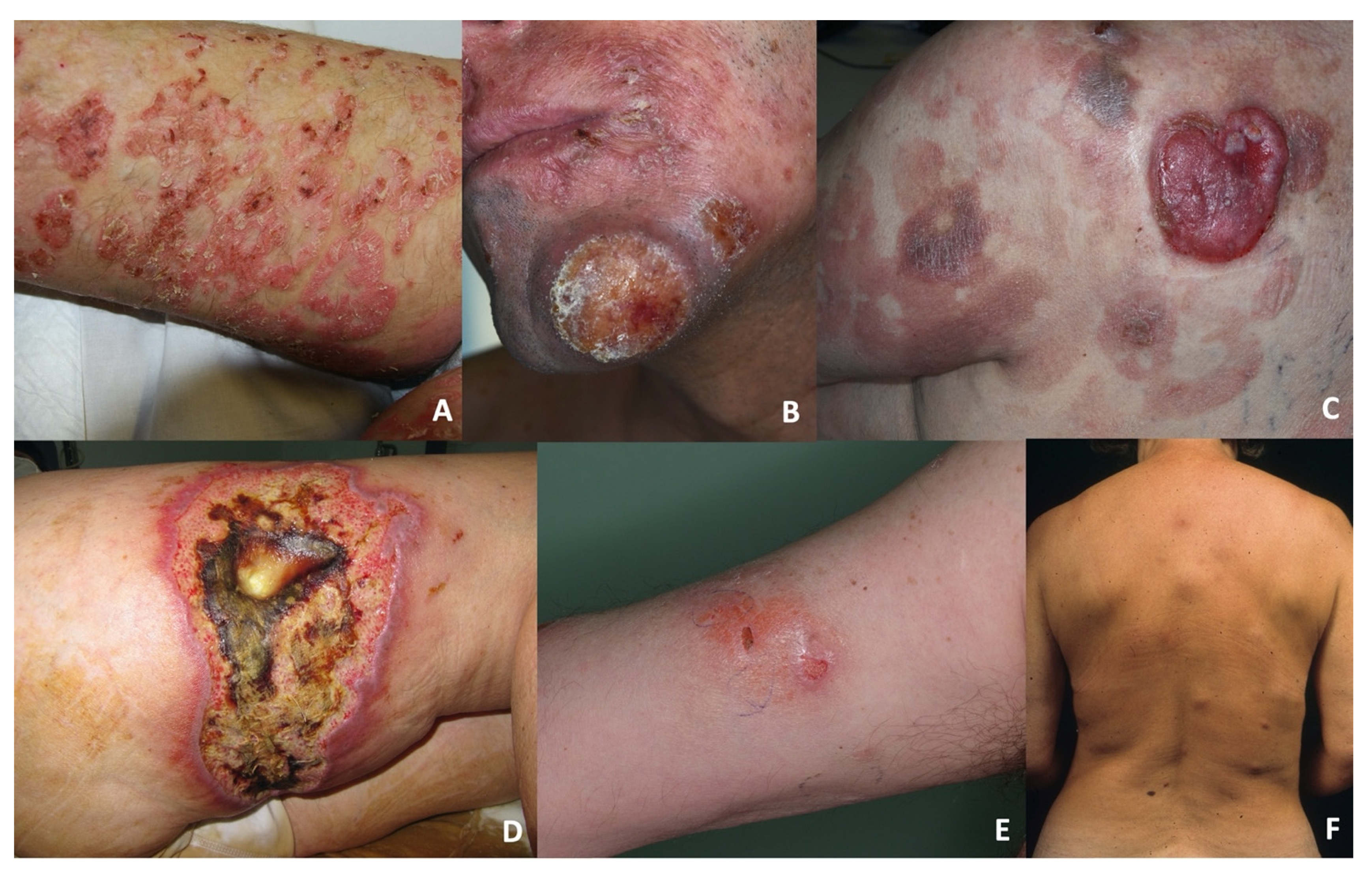 Dermatopathology 08 00054 g001