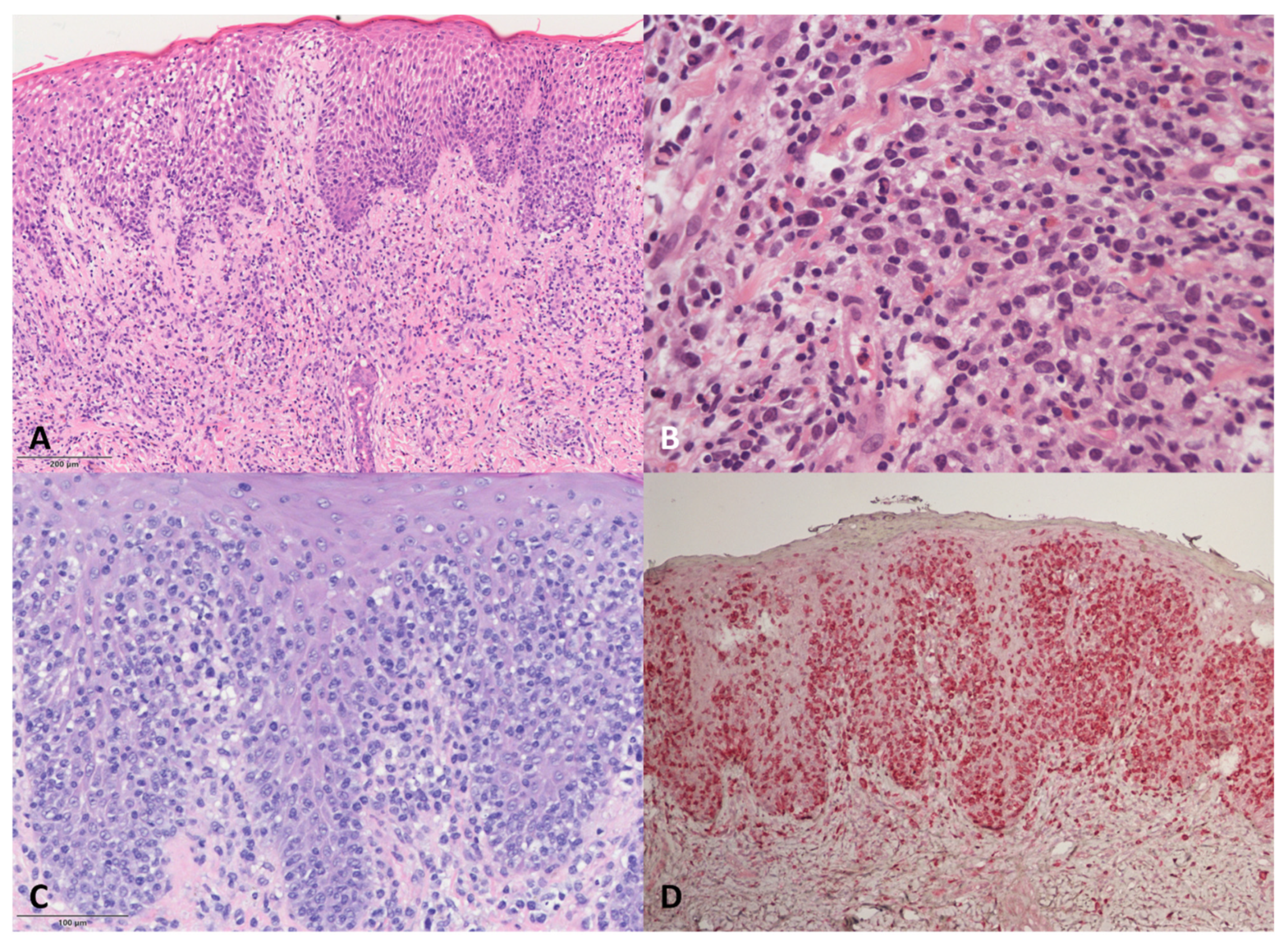 Dermatopathology 08 00054 g002