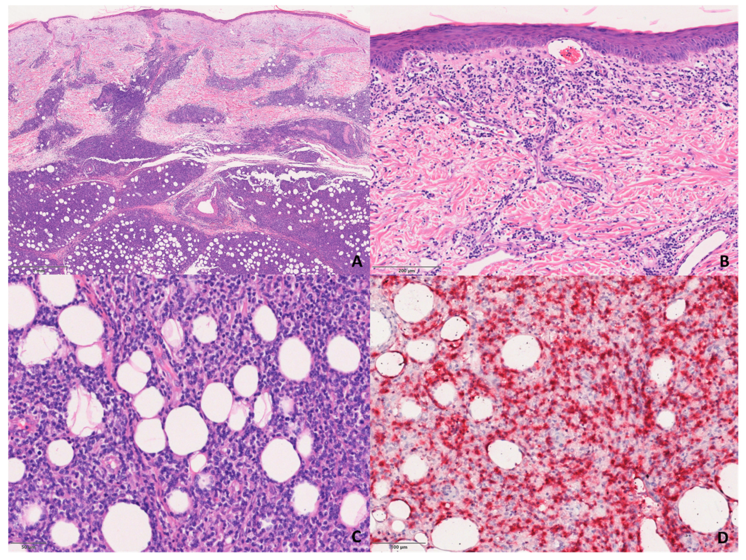 Dermatopathology 08 00054 g003