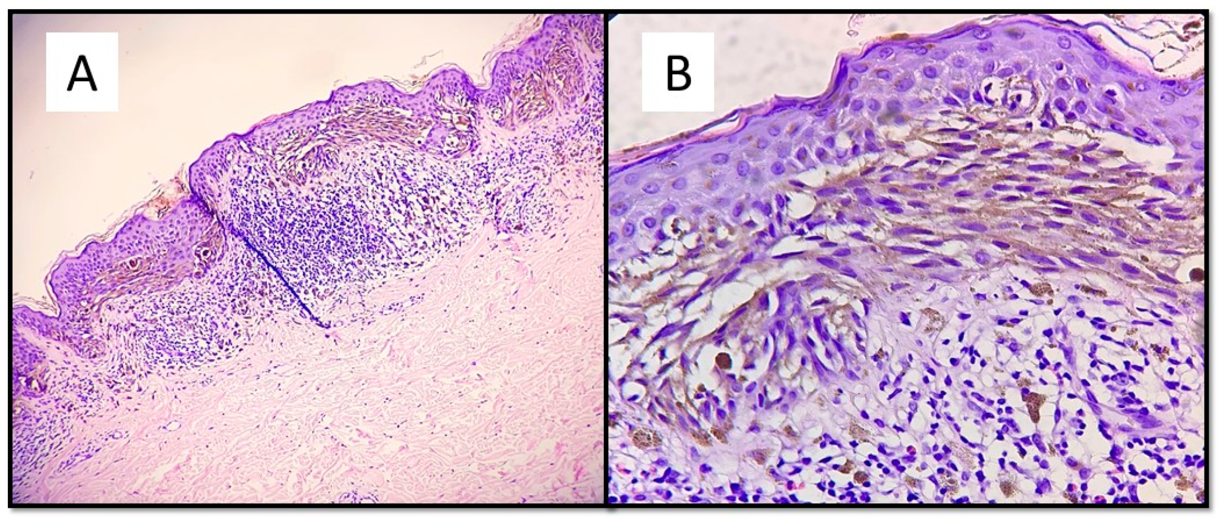 Dermatopathology 08 00055 g002a