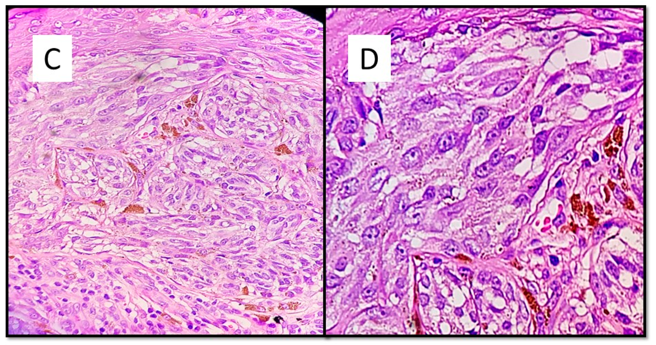 Dermatopathology 08 00055 g002b