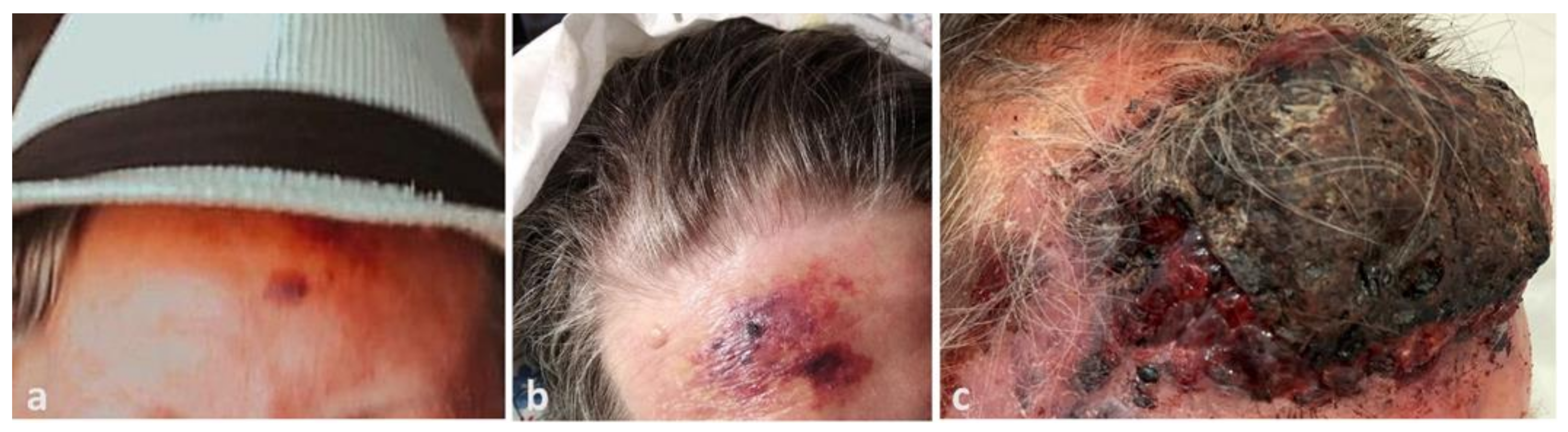 Dermatopathology 08 00057 g001