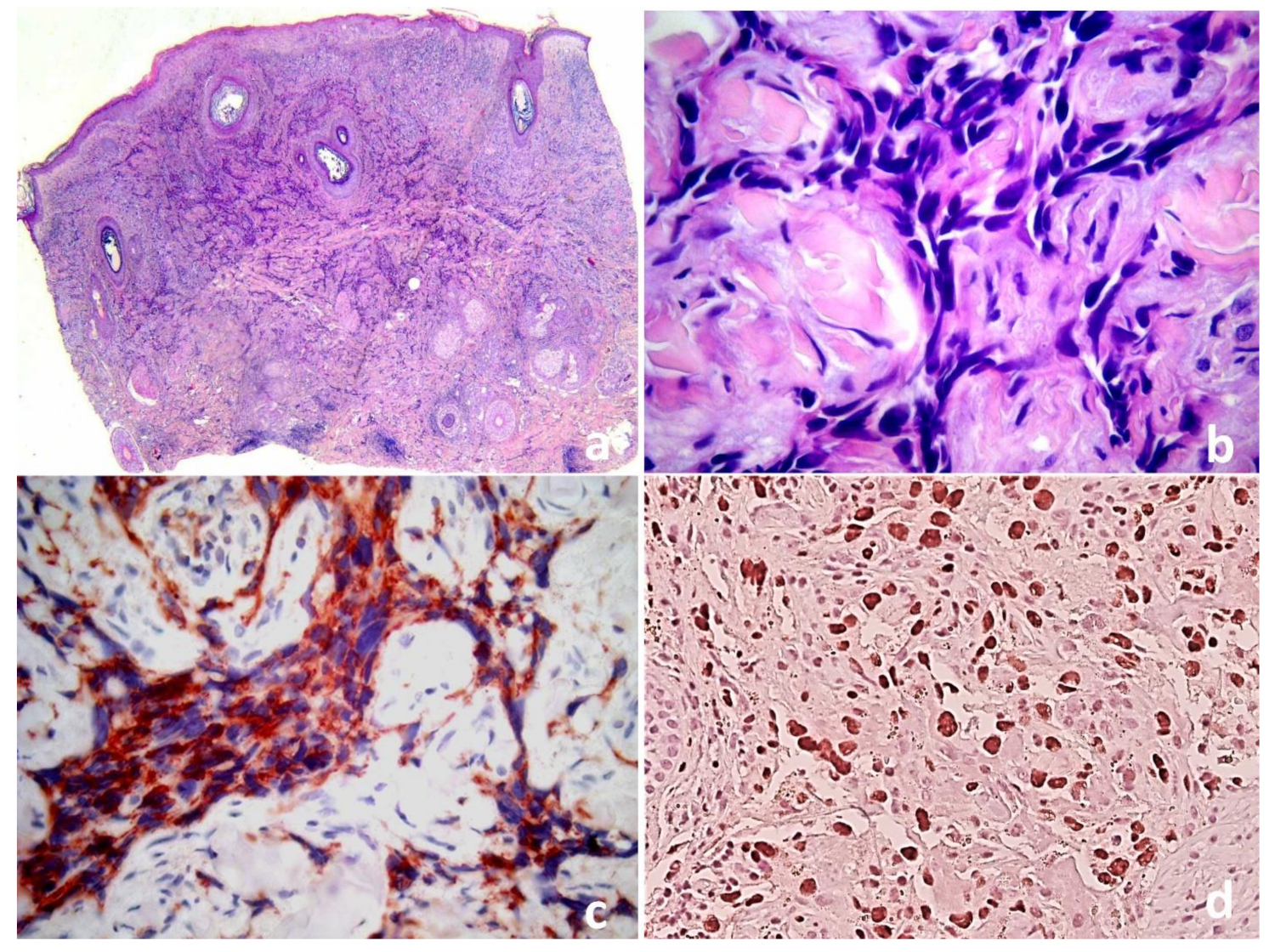 Dermatopathology 08 00057 g002