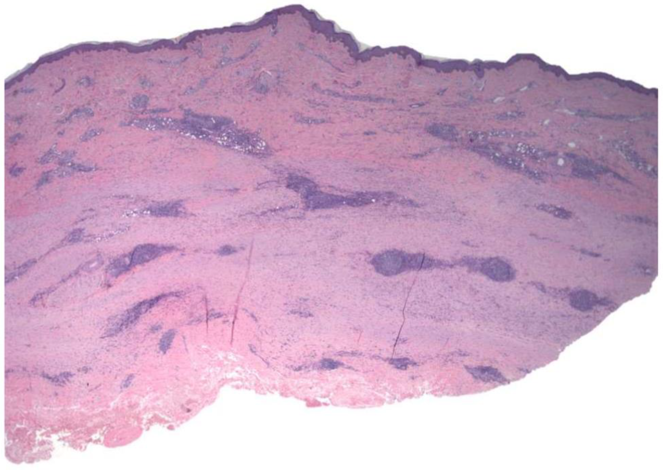 Dermatopathology 09 00003 g003
