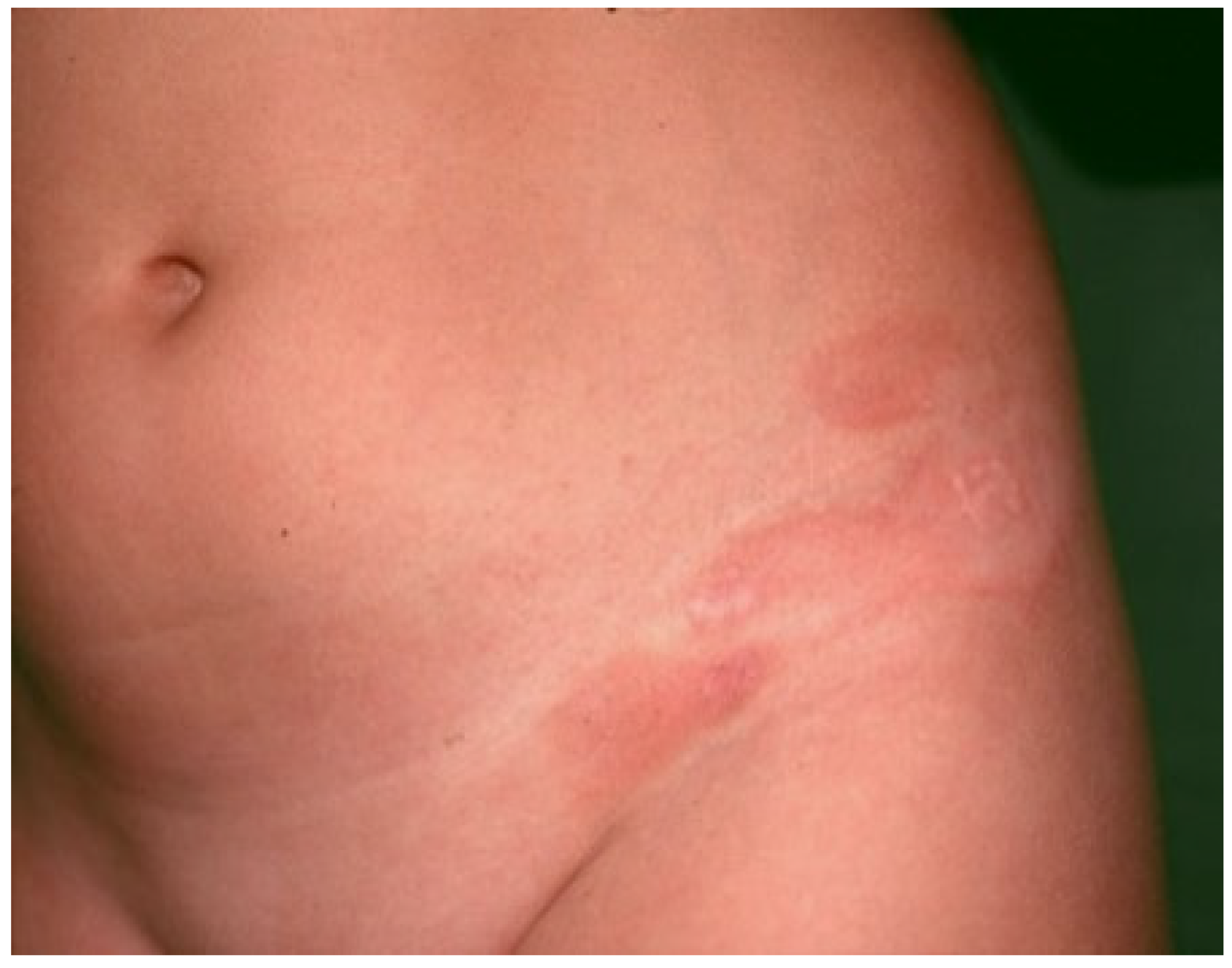 Dermatopathology 09 00004 g001