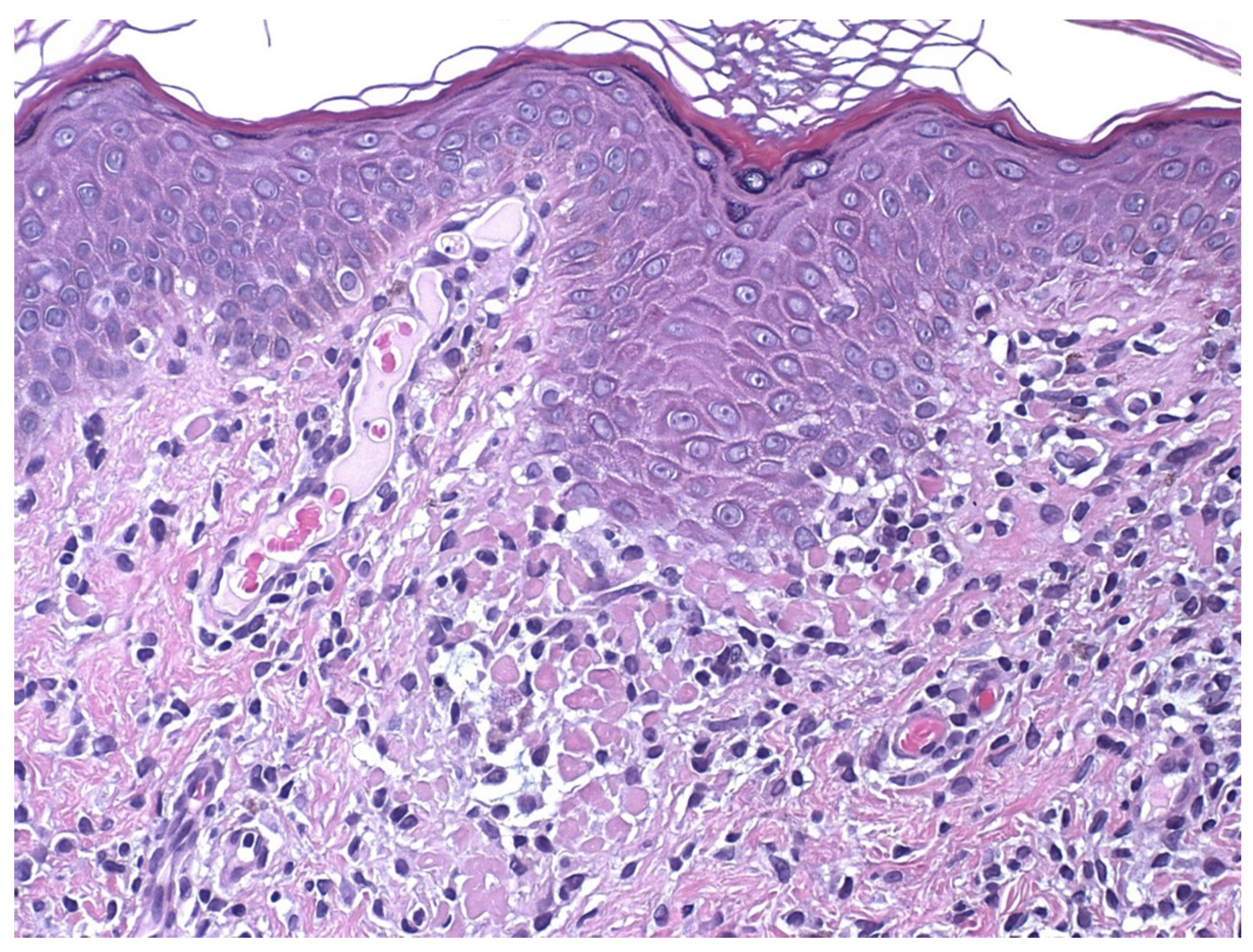 Dermatopathology 09 00004 g006
