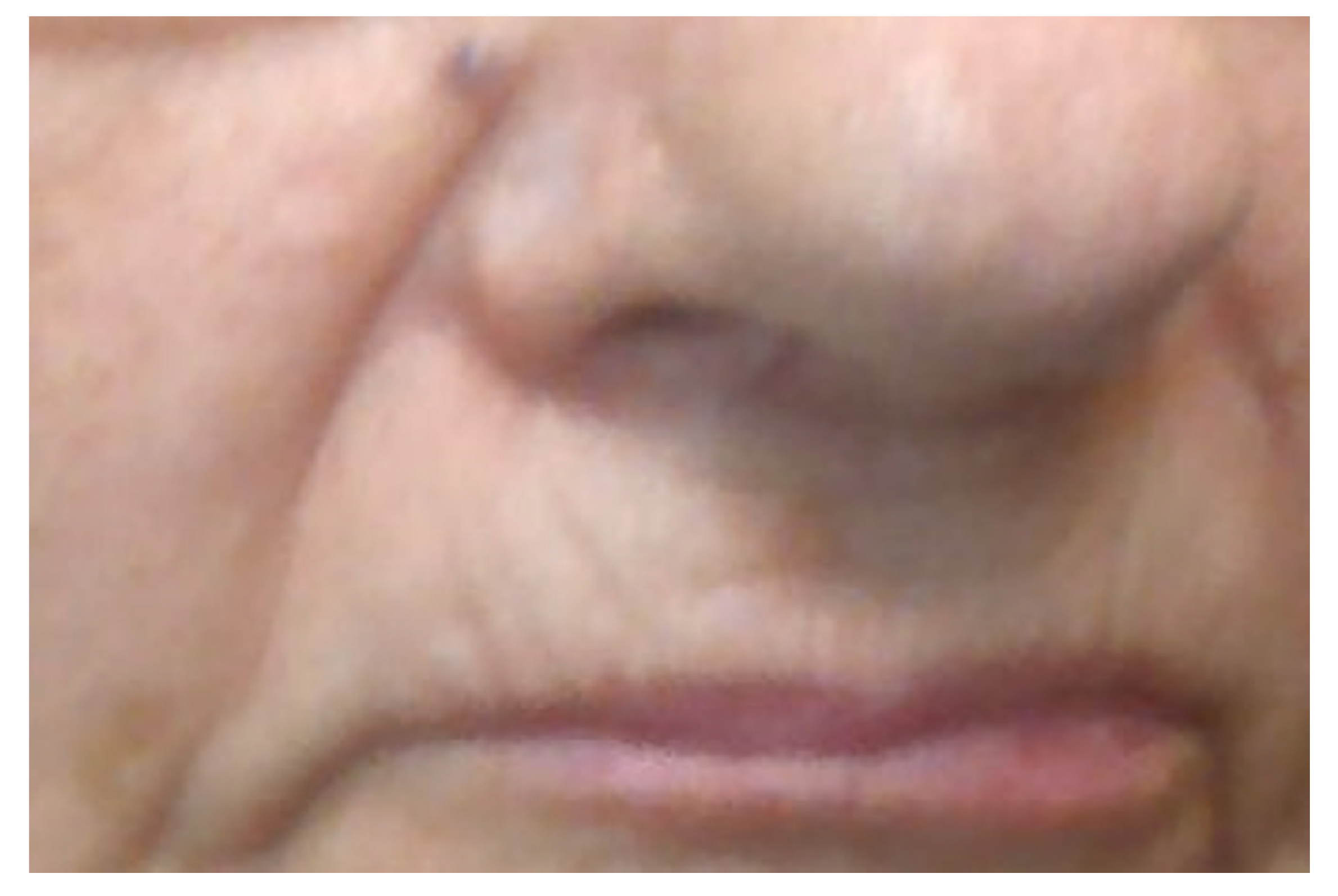 Dermatopathology 09 00007 g002