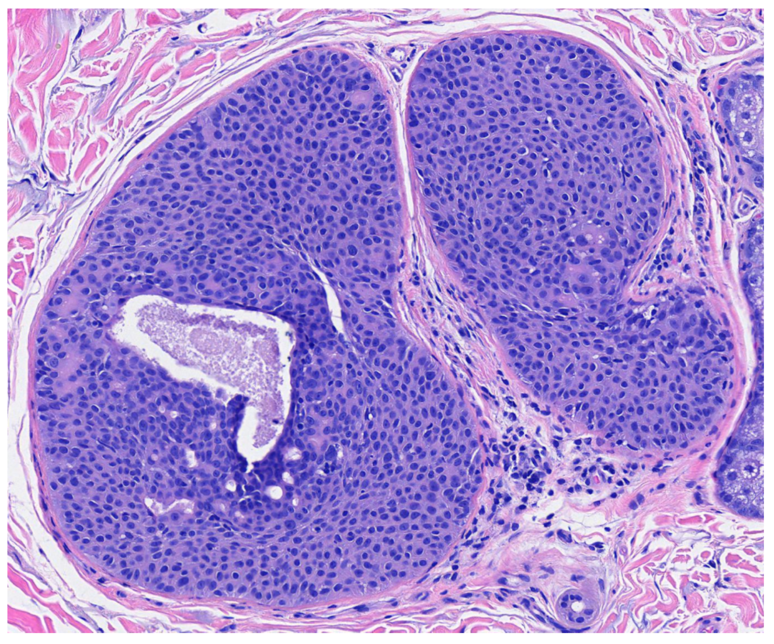 Dermatopathology 09 00007 g005