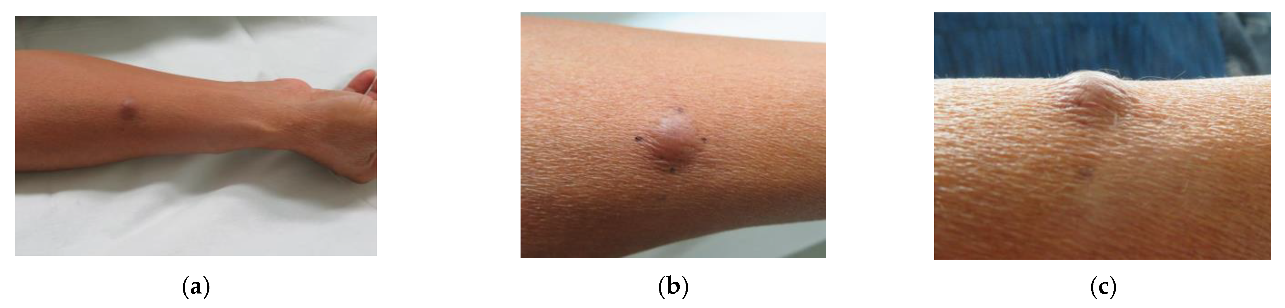 Dermatopathology 09 00012 g001