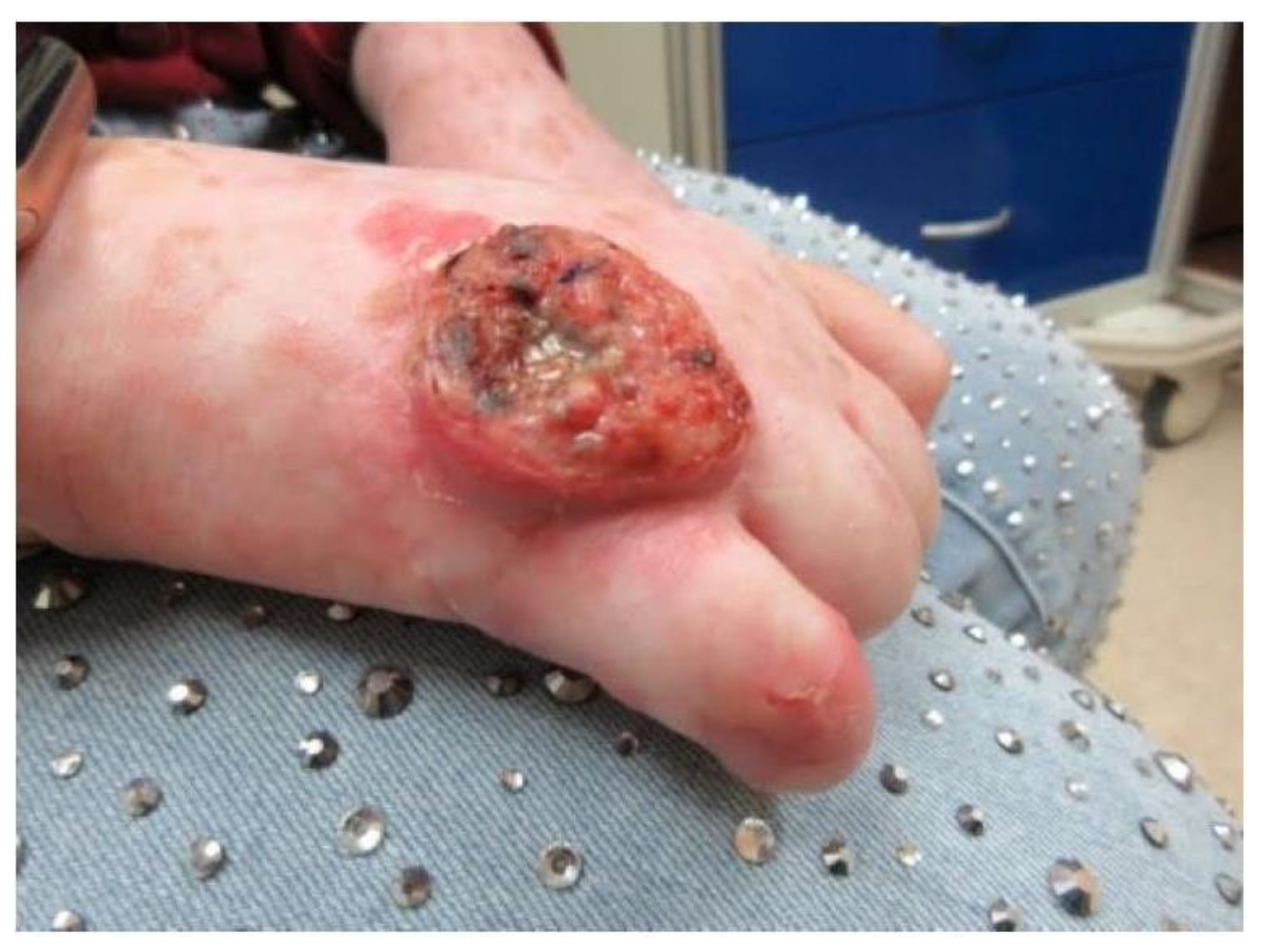 Dermatopathology 09 00015 g002 Dermatopathology 09 00015 g002