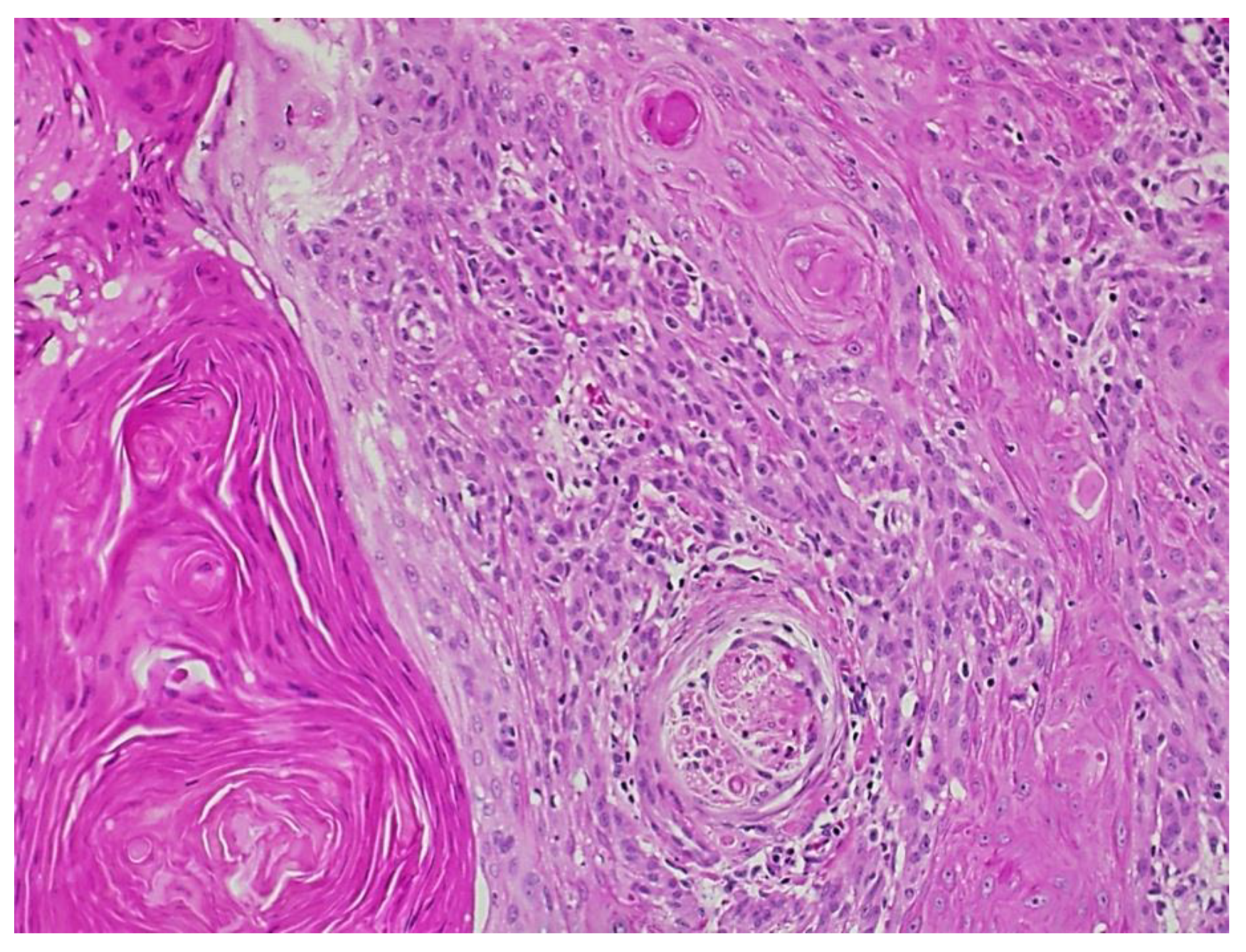 Dermatopathology 09 00015 g003 Dermatopathology 09 00015 g003