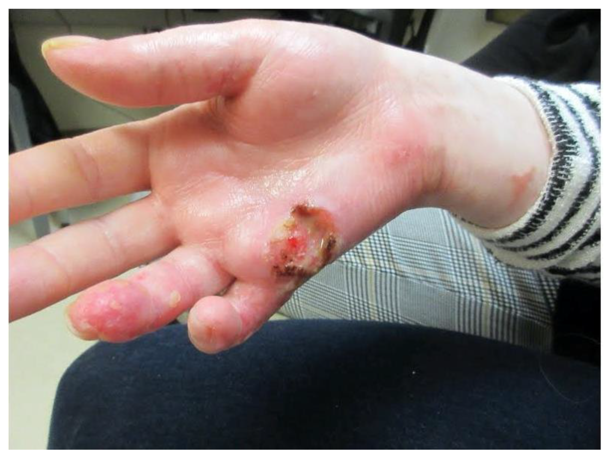 Dermatopathology 09 00015 g004 Dermatopathology 09 00015 g004