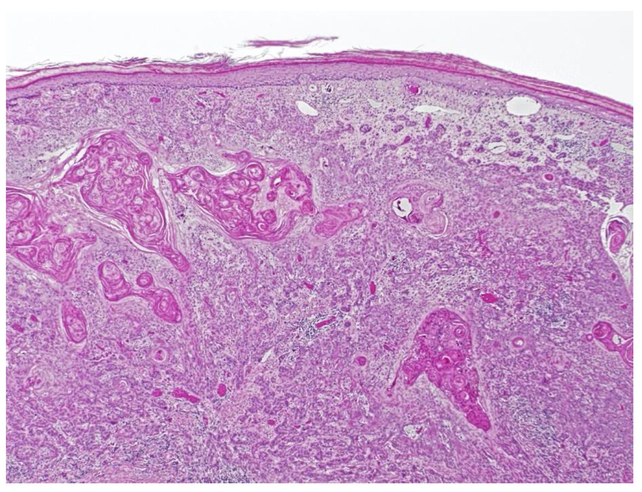 Dermatopathology 09 00015 g005 Dermatopathology 09 00015 g005