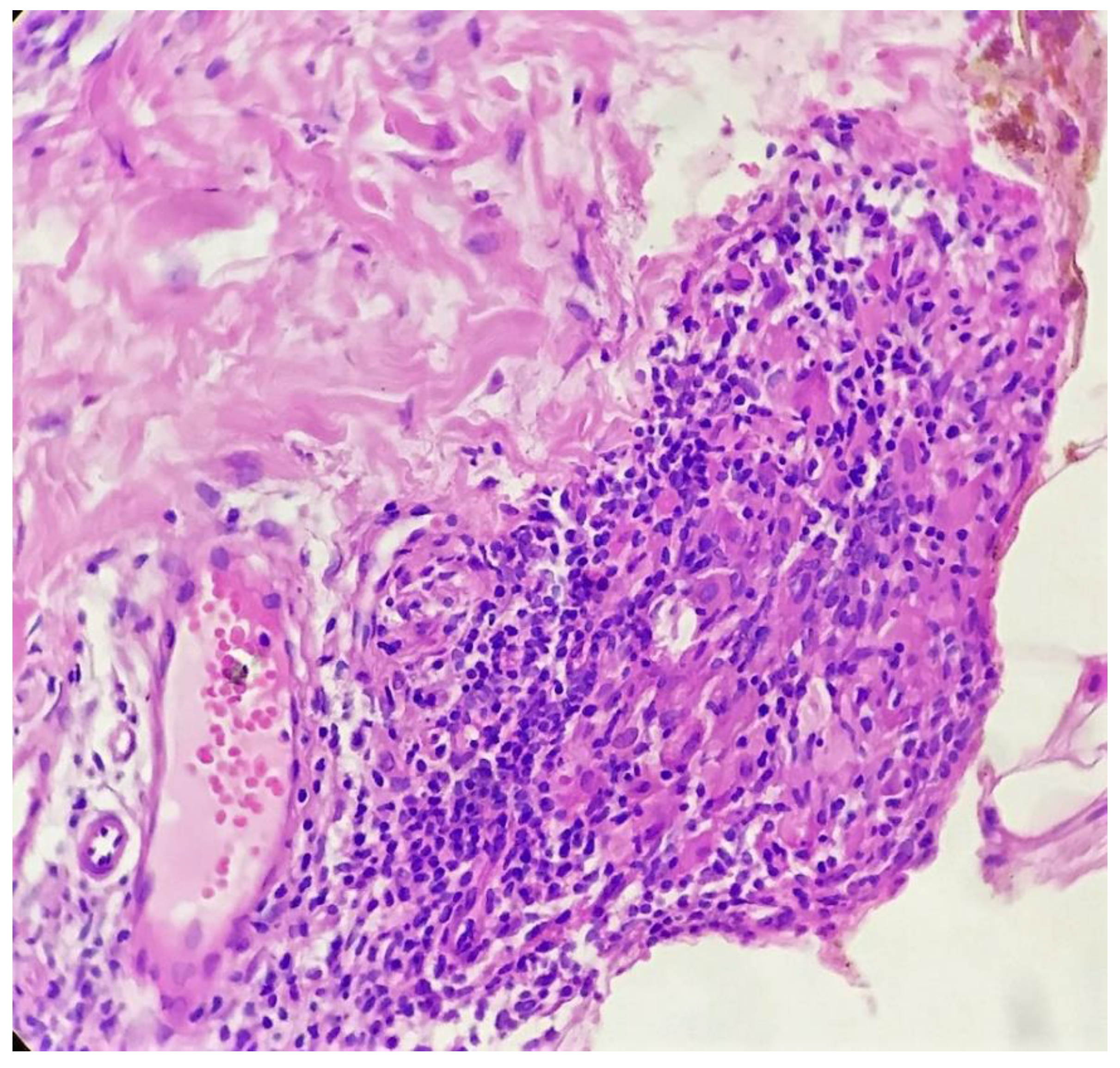 Dermatopathology 09 00016 g005