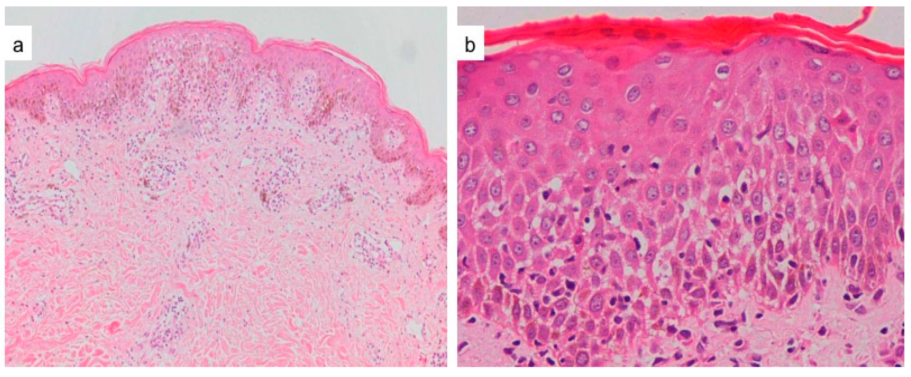 Dermatopathology 09 00021 g003