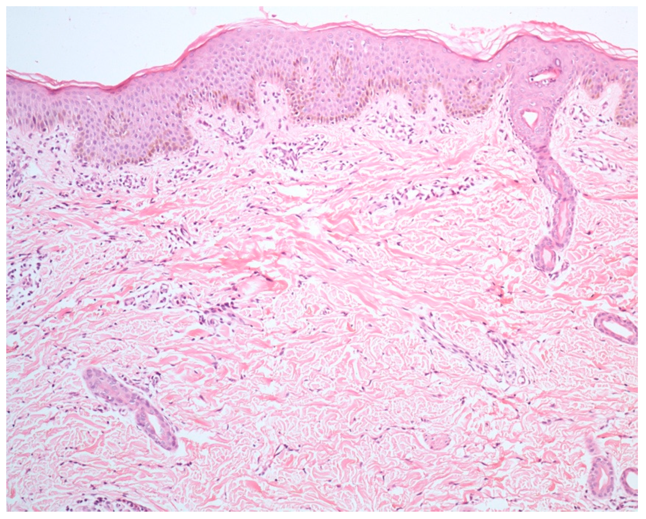 Dermatopathology 09 00021 g004