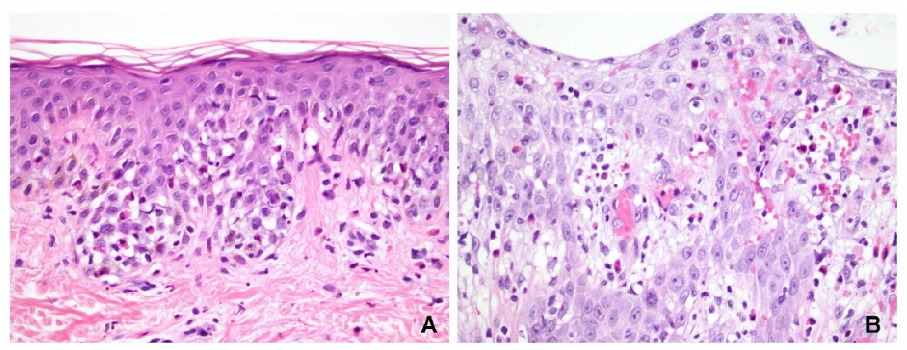 Dermatopathology 09 00022 g004