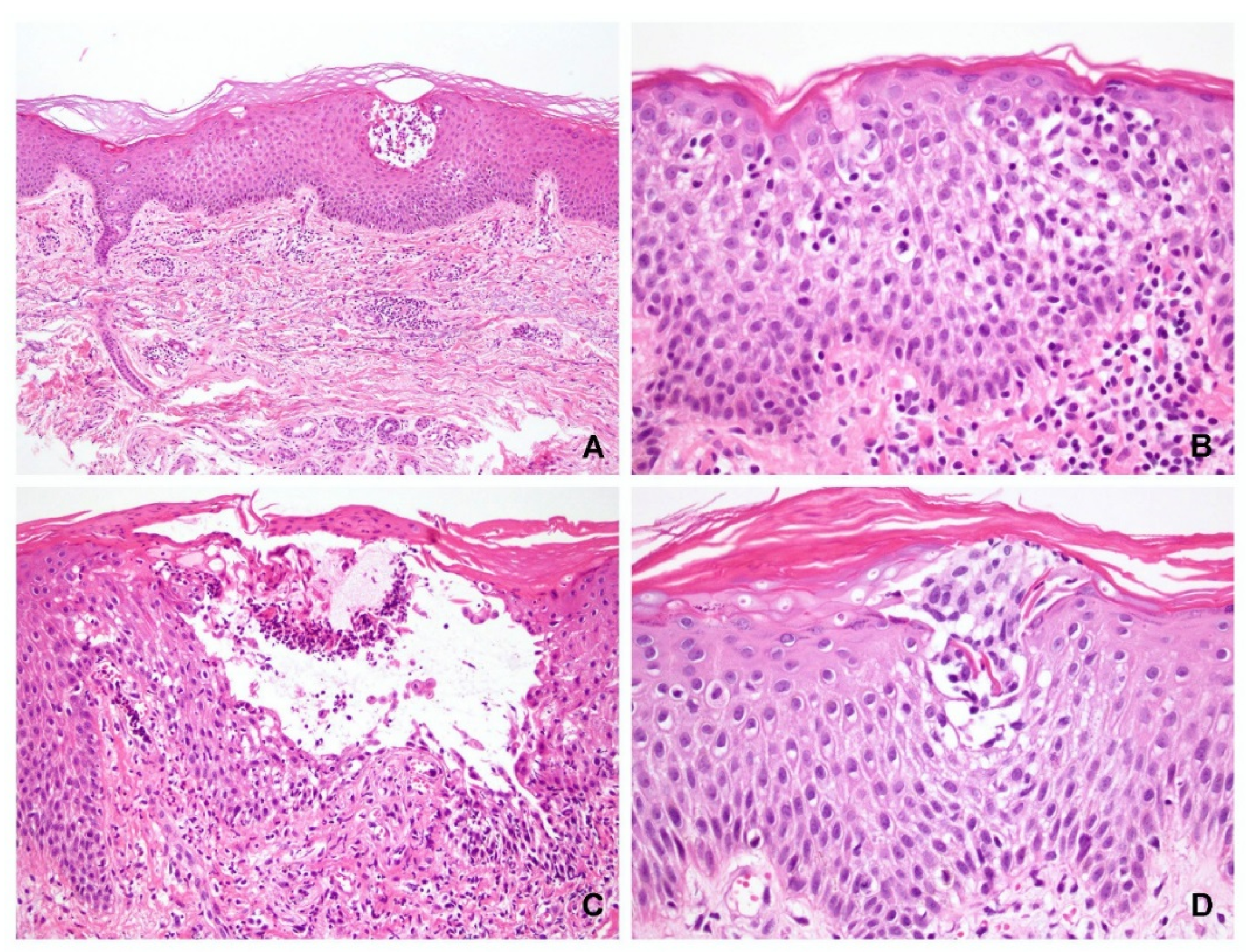 Dermatopathology 09 00022 g005