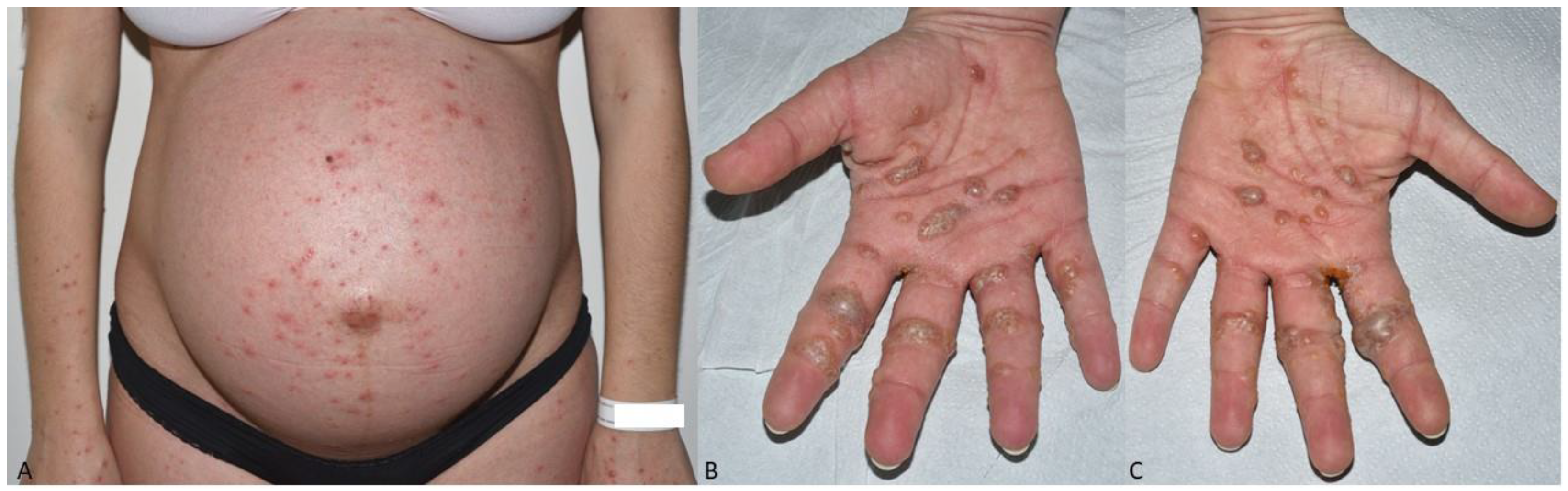 Dermatopathology 09 00025 g001 Dermatopathology 09 00025 g001