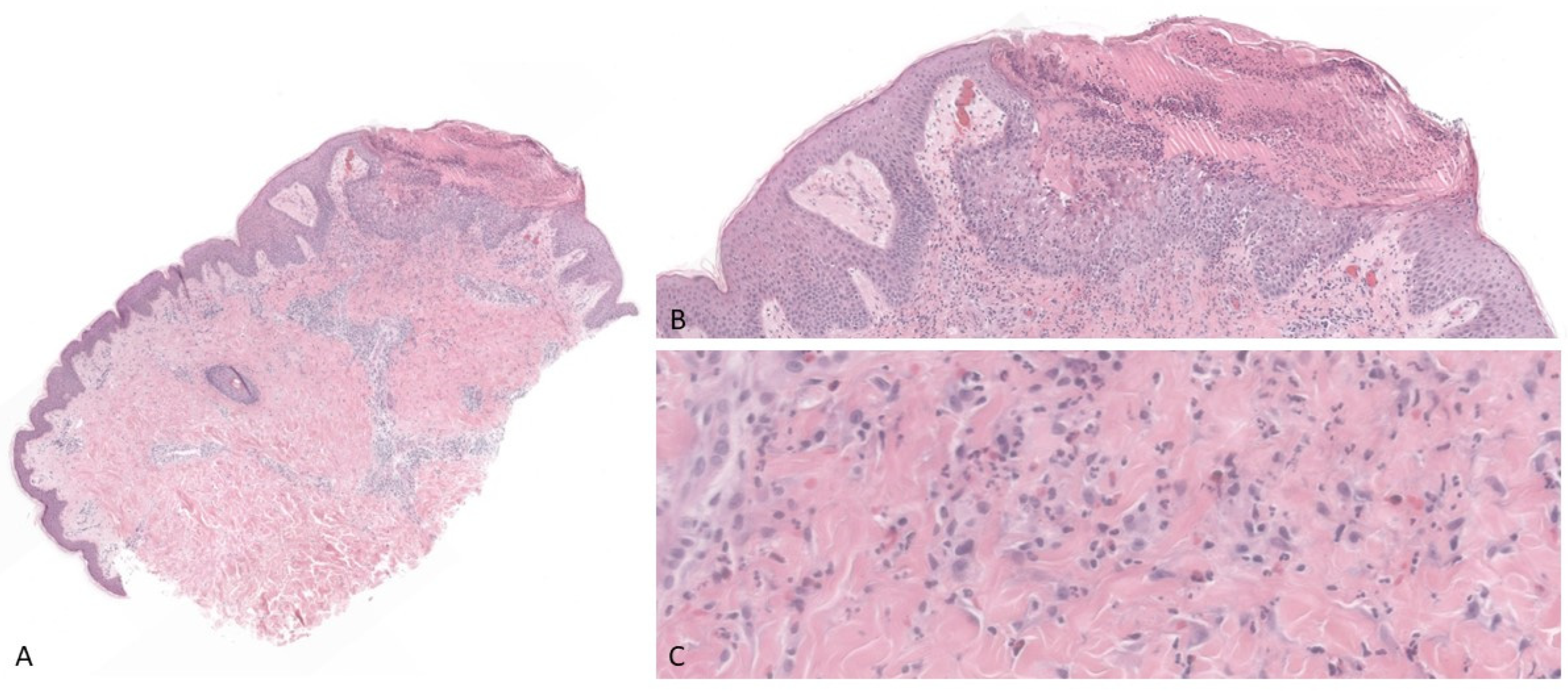 Dermatopathology 09 00025 g002 Dermatopathology 09 00025 g002