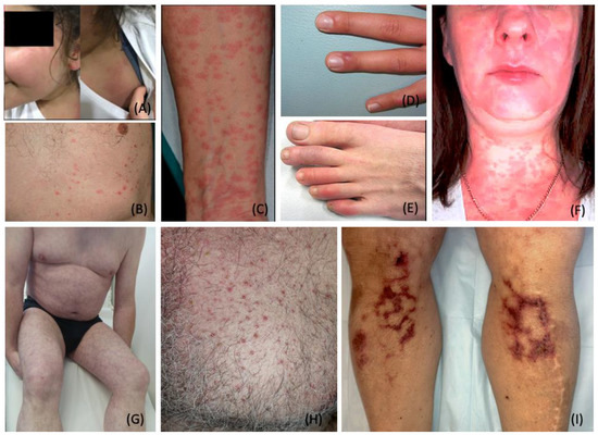 Dermatopathology 09 00027 g002