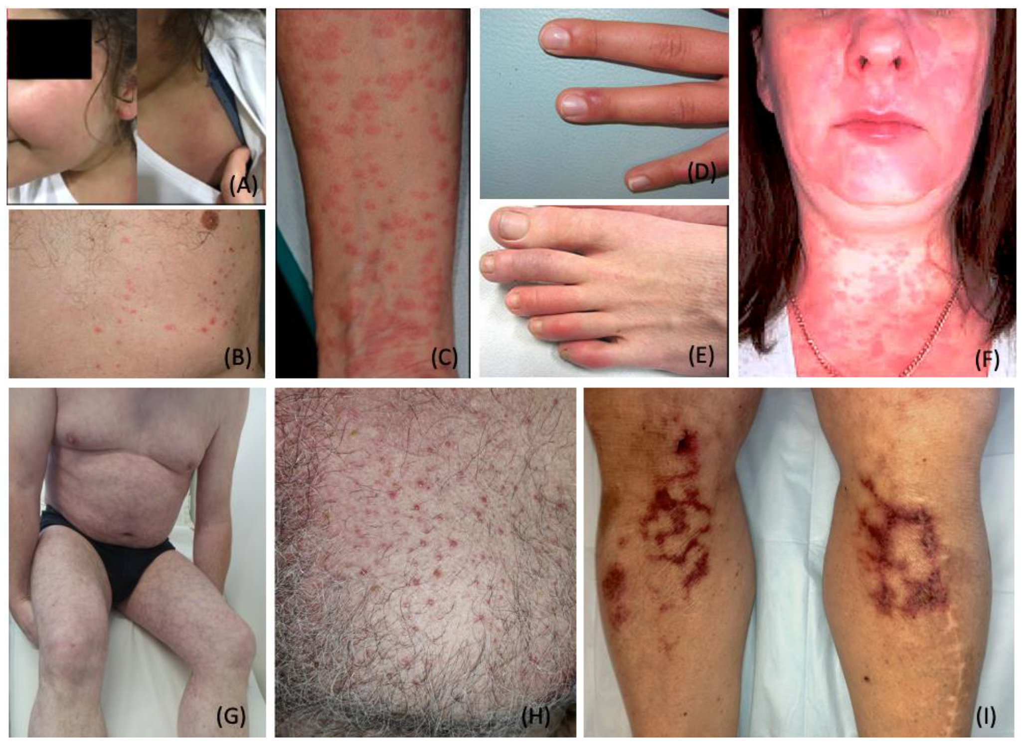 Dermatopathology 09 00027 g002 Dermatopathology 09 00027 g002
