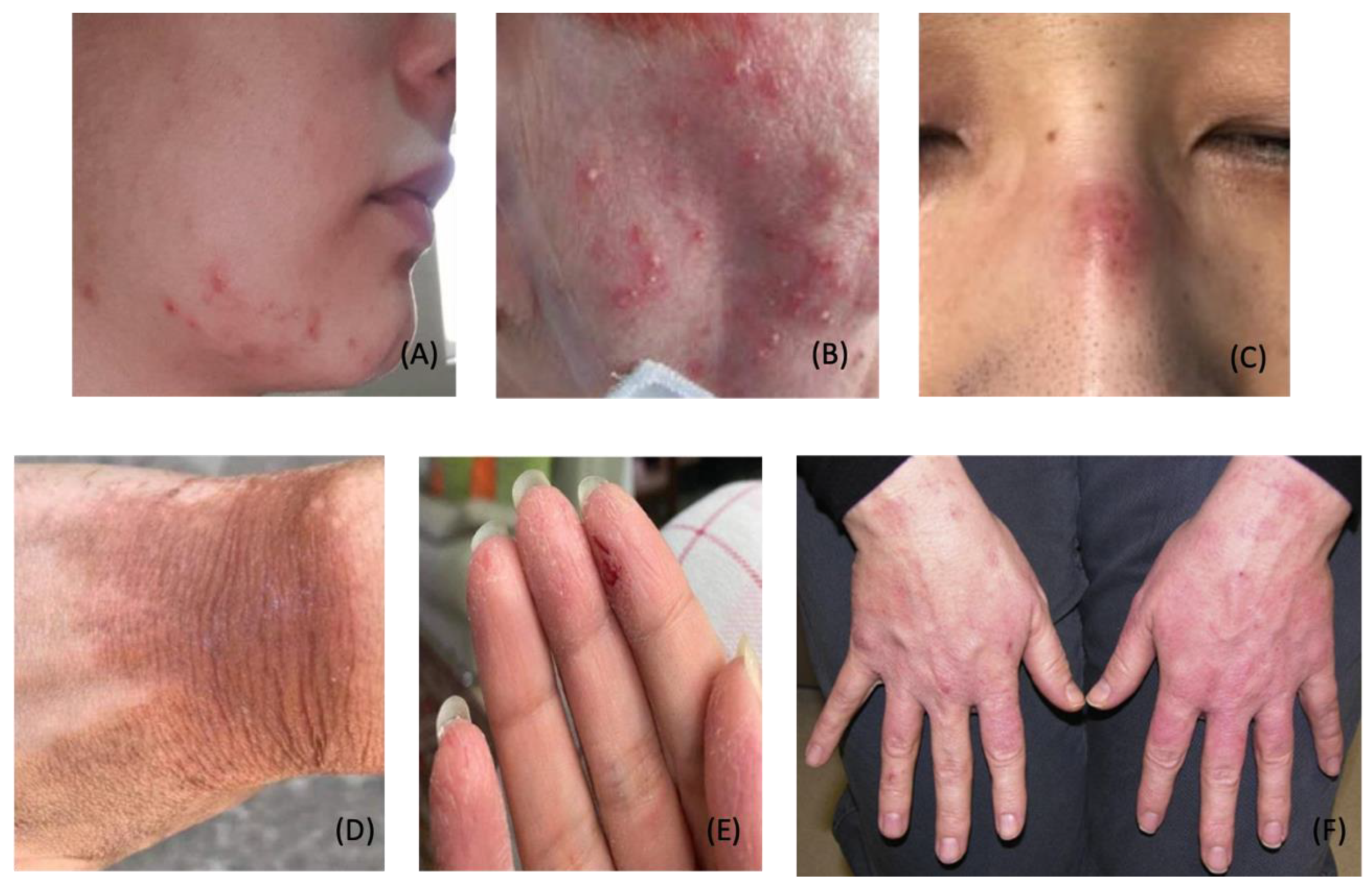 Dermatopathology 09 00027 g003 Dermatopathology 09 00027 g003