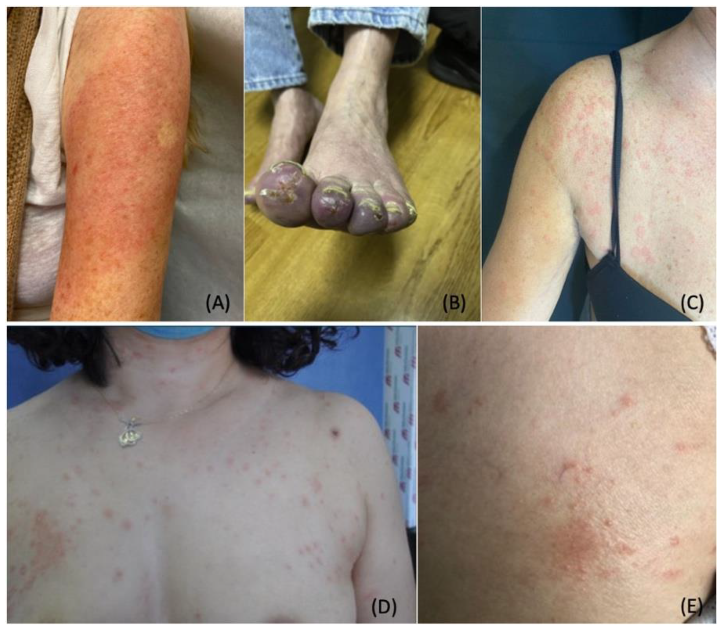 Dermatopathology 09 00027 g004 Dermatopathology 09 00027 g004
