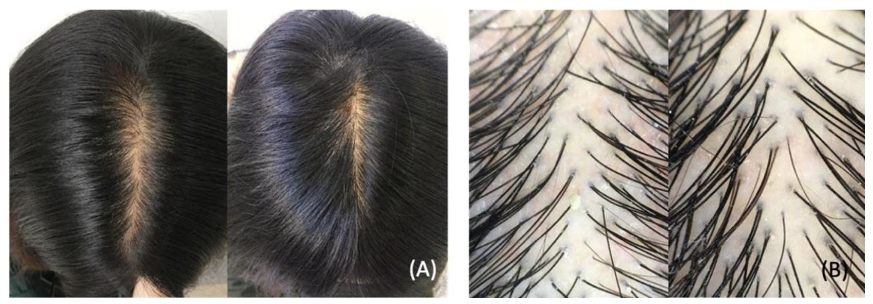 Dermatopathology 09 00027 g005 Dermatopathology 09 00027 g005