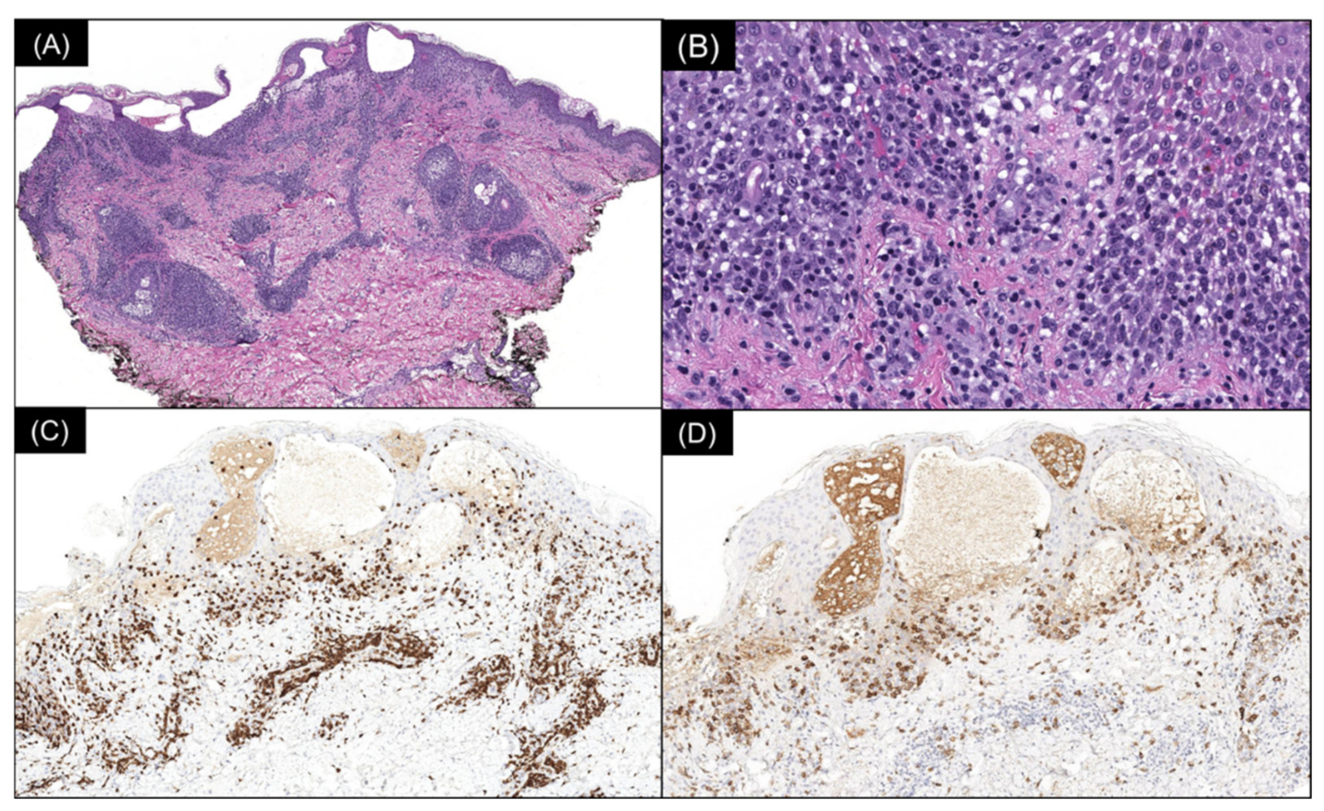 Dermatopathology 09 00028 g003