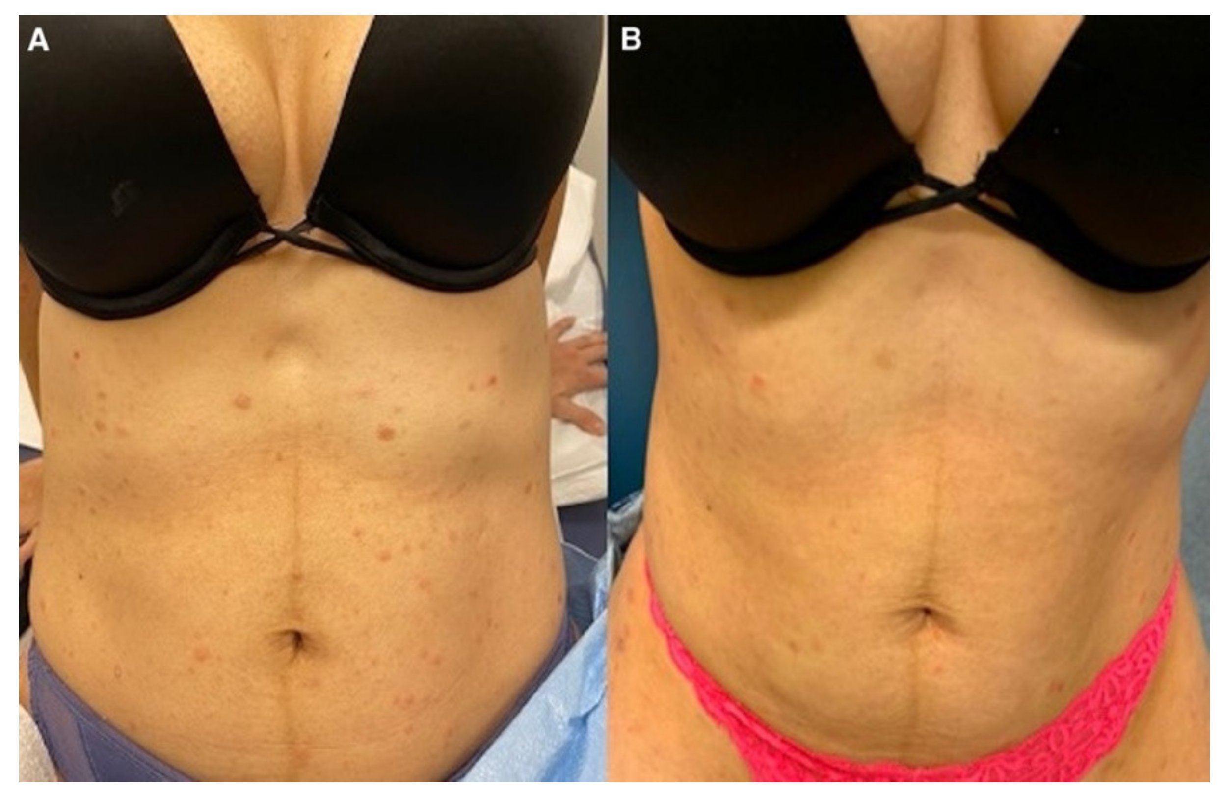 Dermatopathology 09 00028 g004