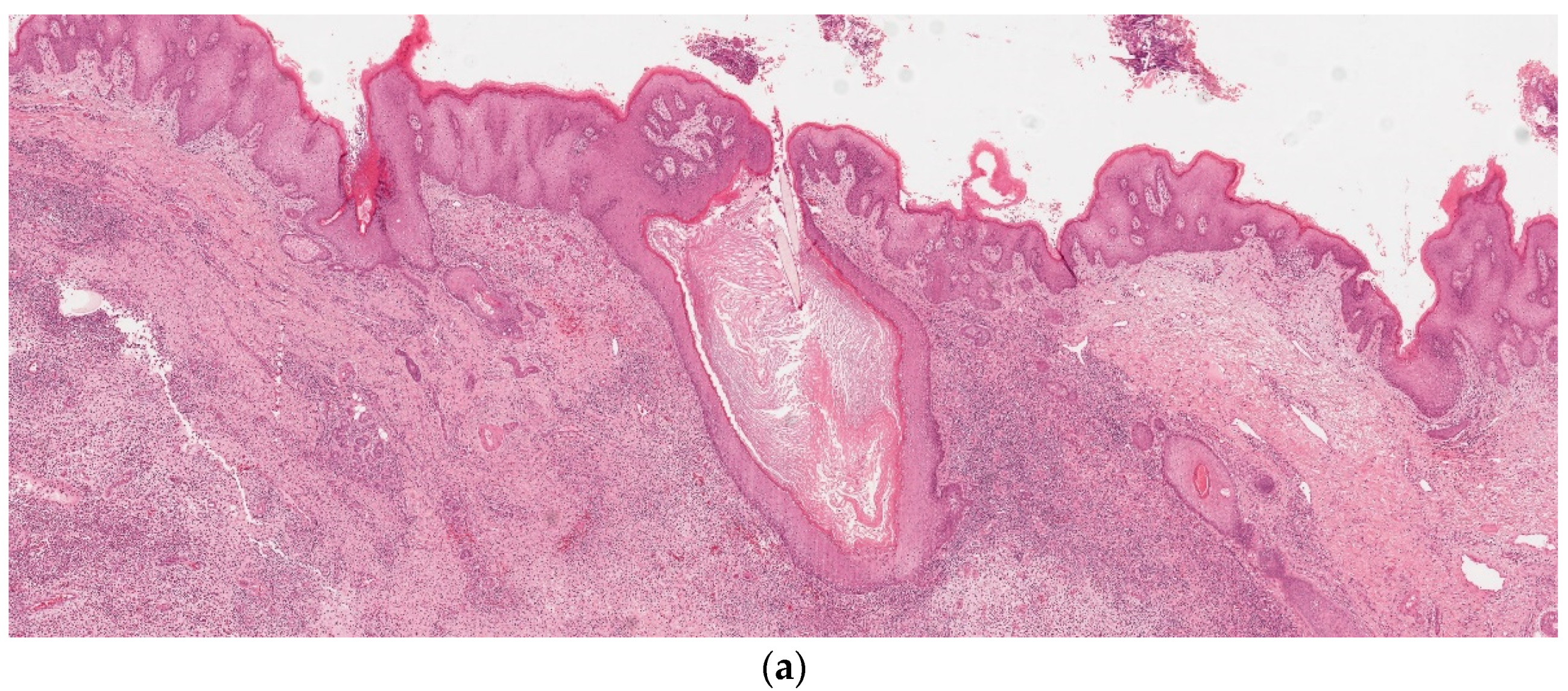 Dermatopathology 09 00029 g002a