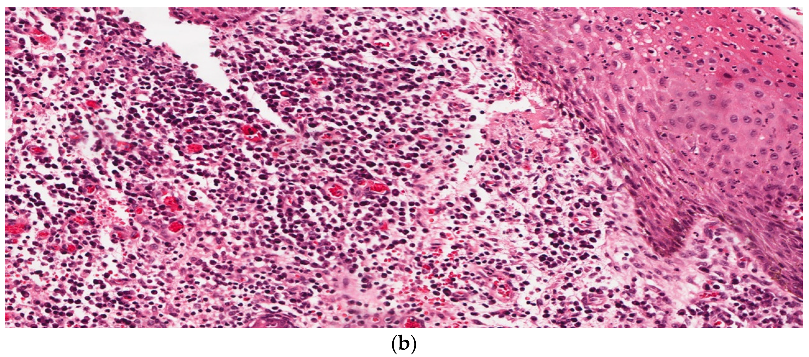 Dermatopathology 09 00029 g002b