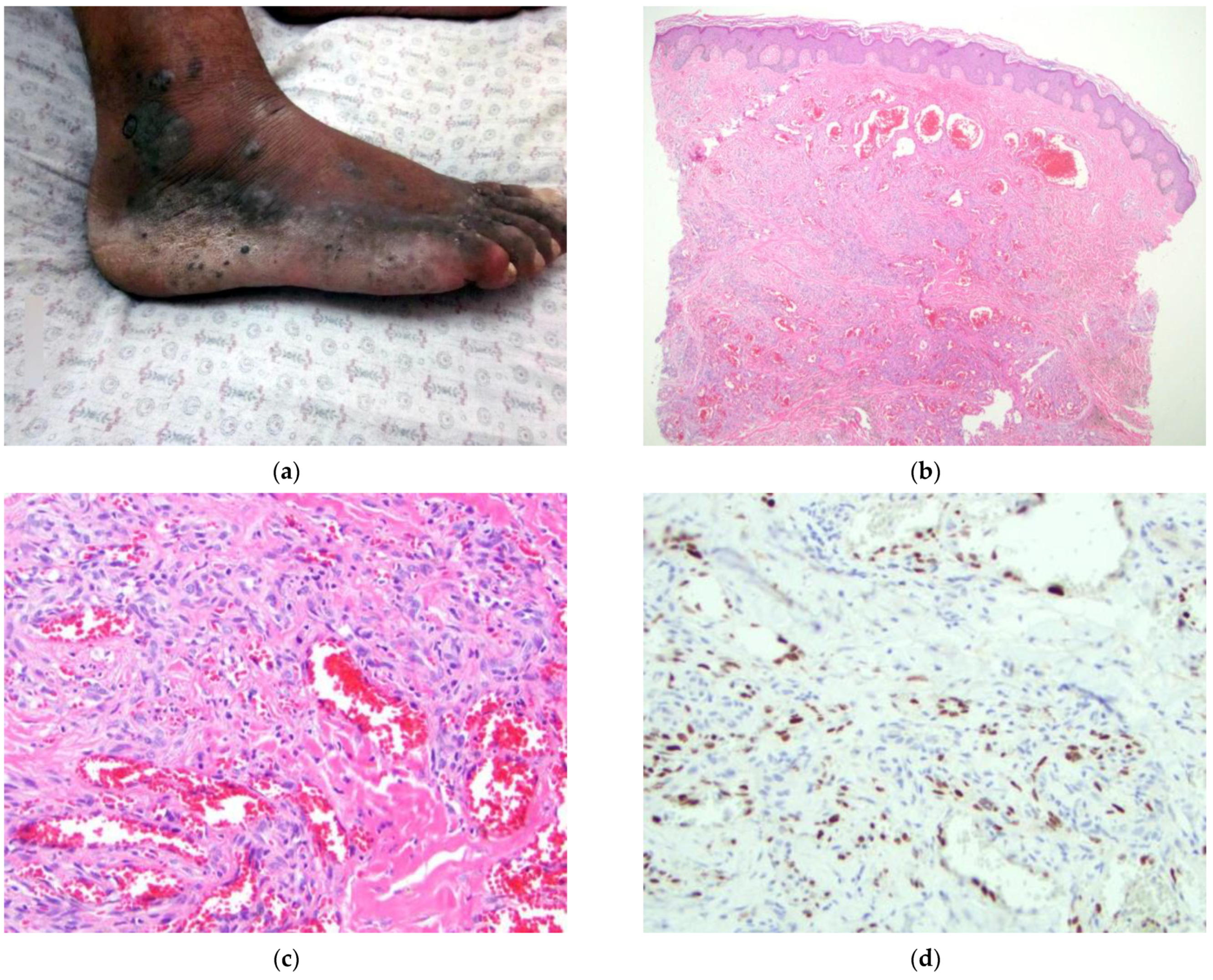 Dermatopathology 09 00030 g005