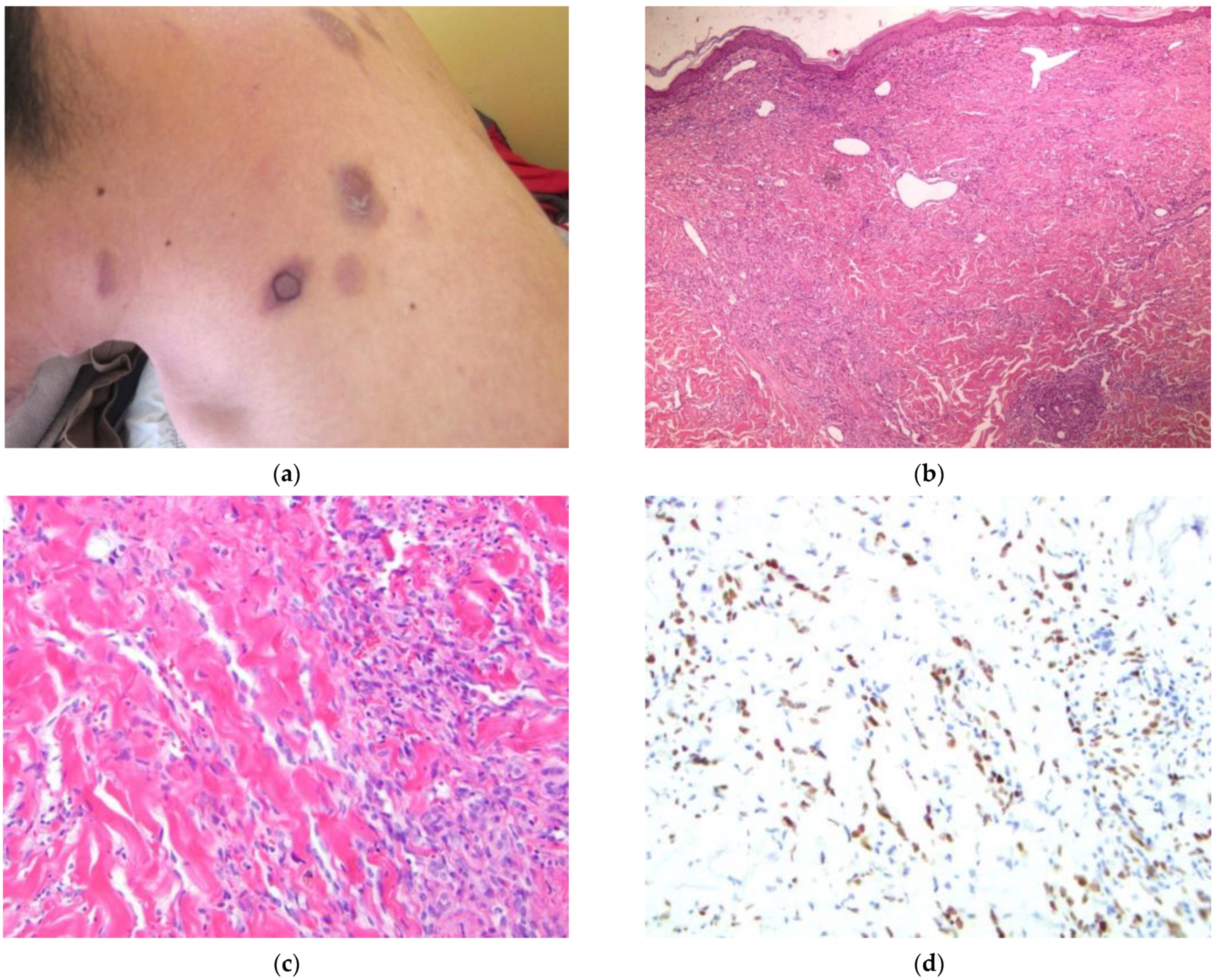 Dermatopathology 09 00030 g006