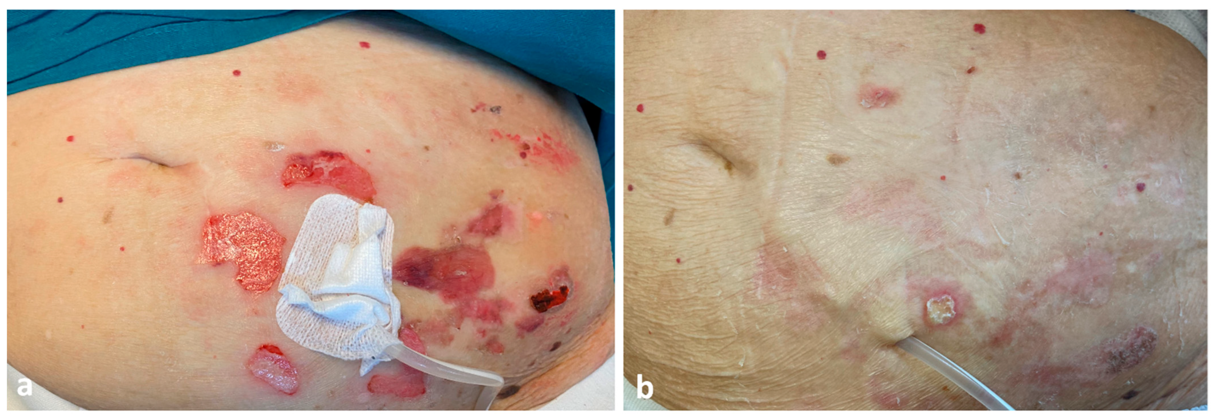 Dermatopathology 09 00033 g003